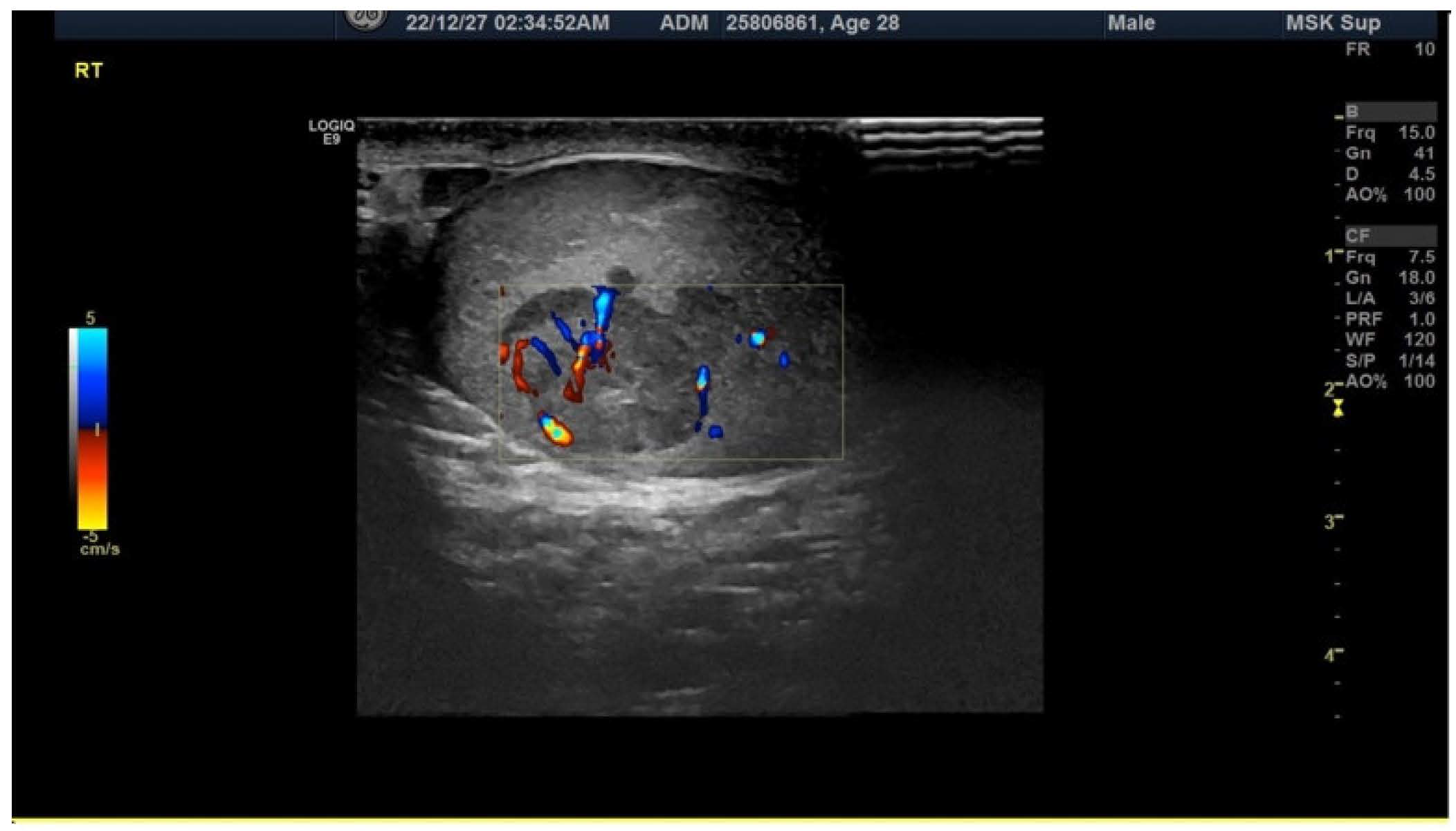 Diagnostics 13 01993 g001