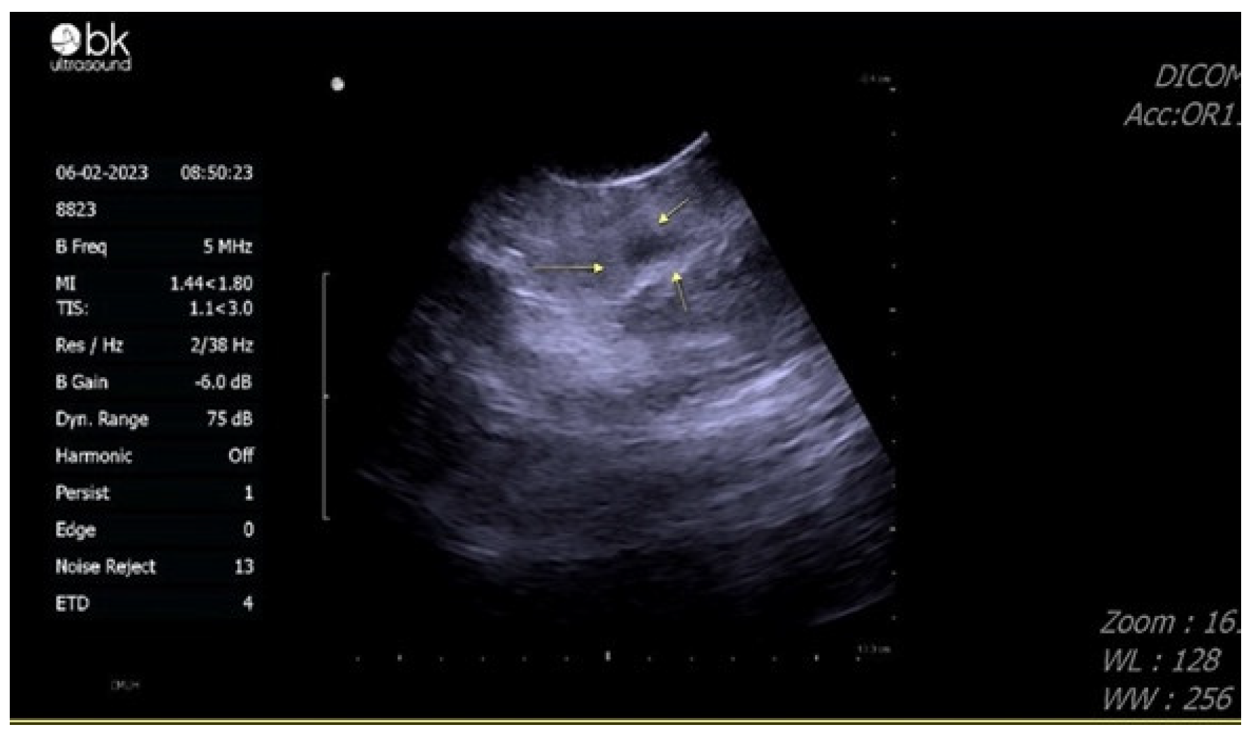 Diagnostics 13 01993 g003