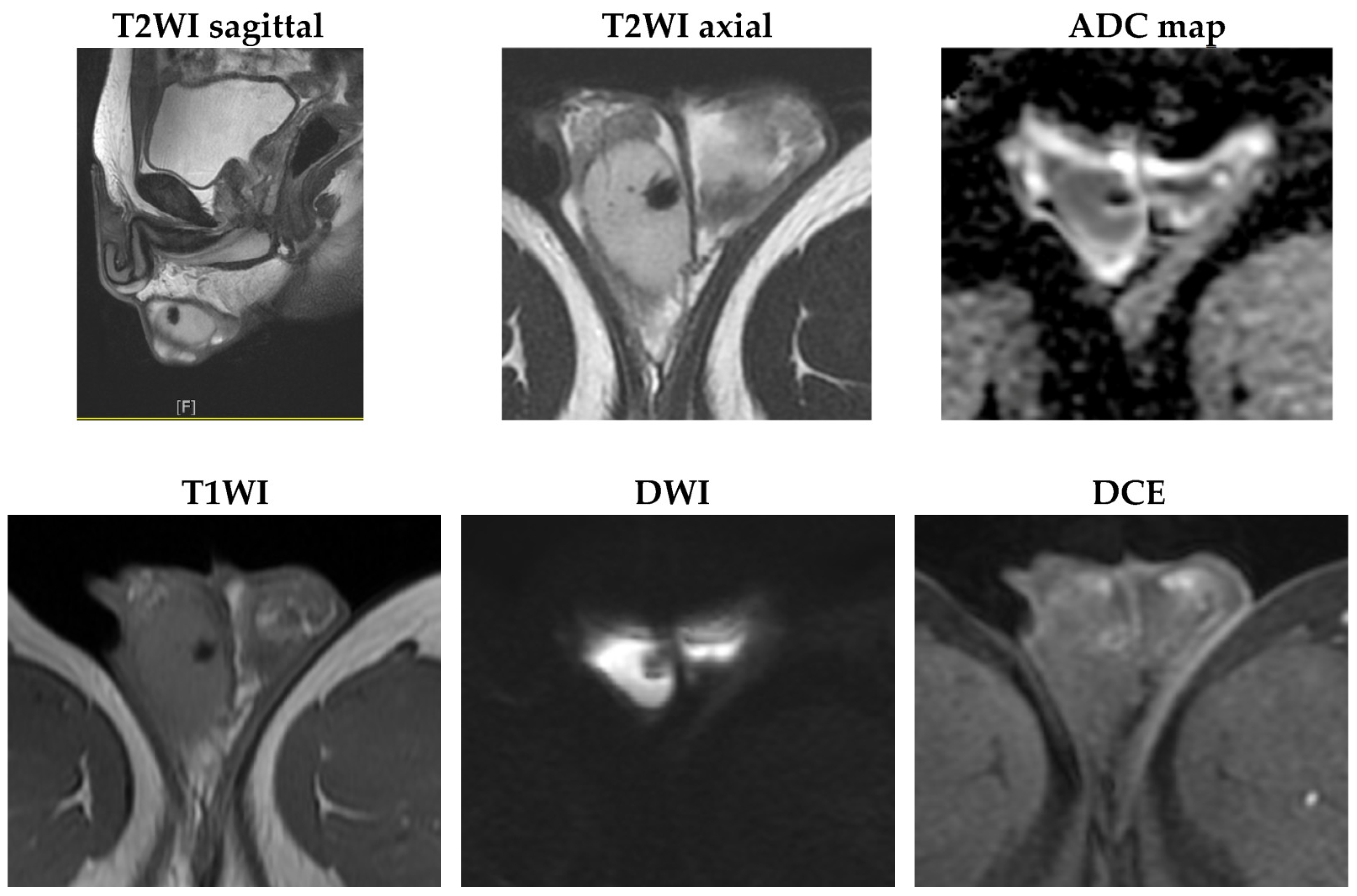 Diagnostics 13 01993 g004