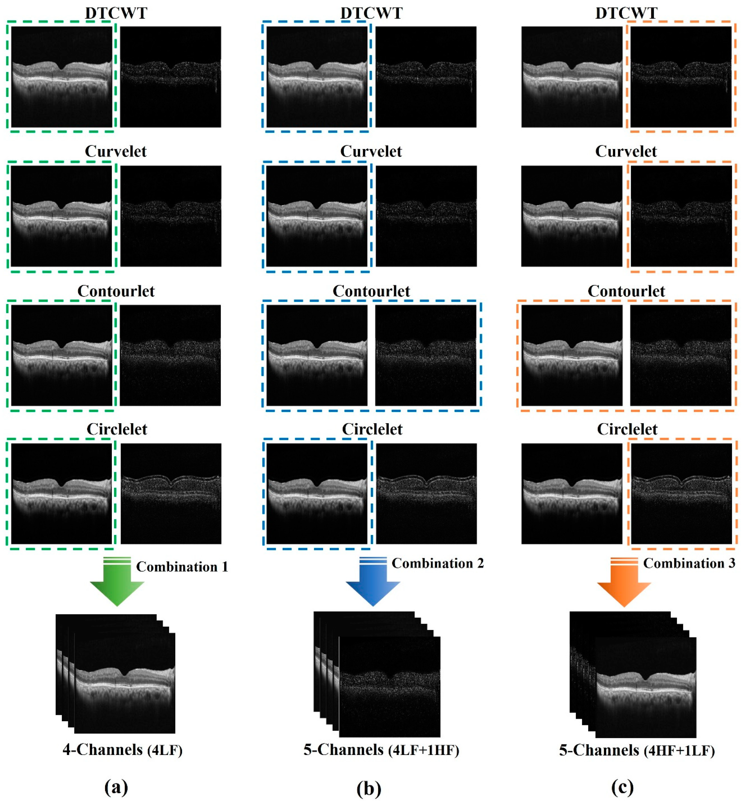 Diagnostics 13 01994 g003