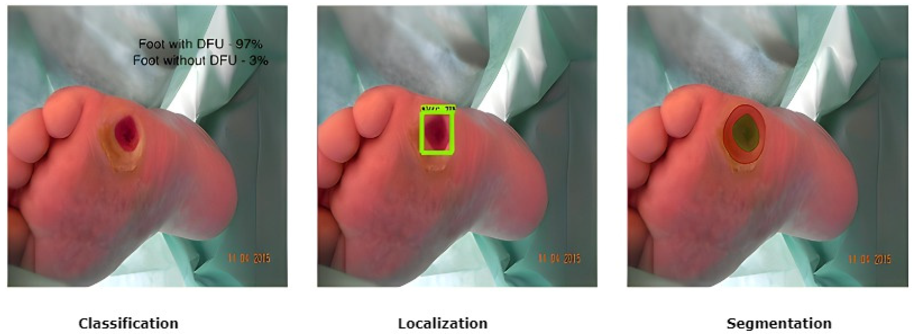 Diagnostics 13 01998 g003 Diagnostics 13 01998 g003