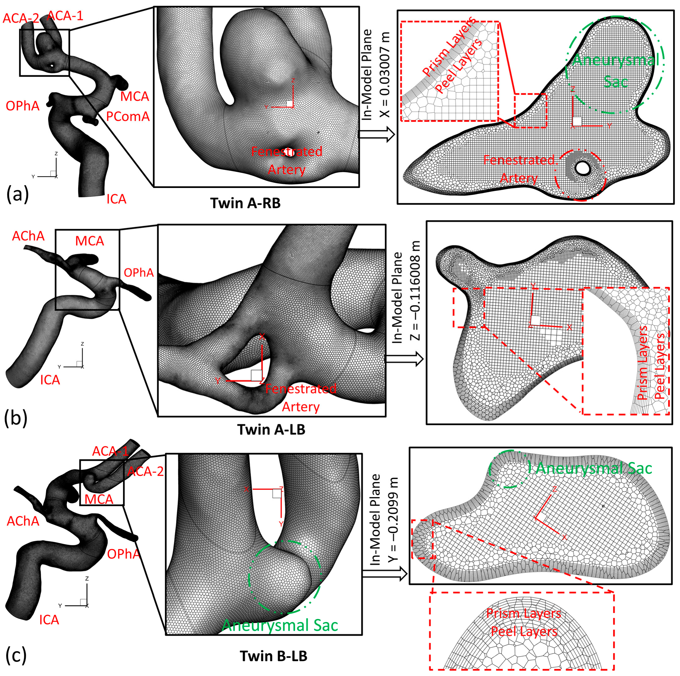 Diagnostics 13 02004 g004
