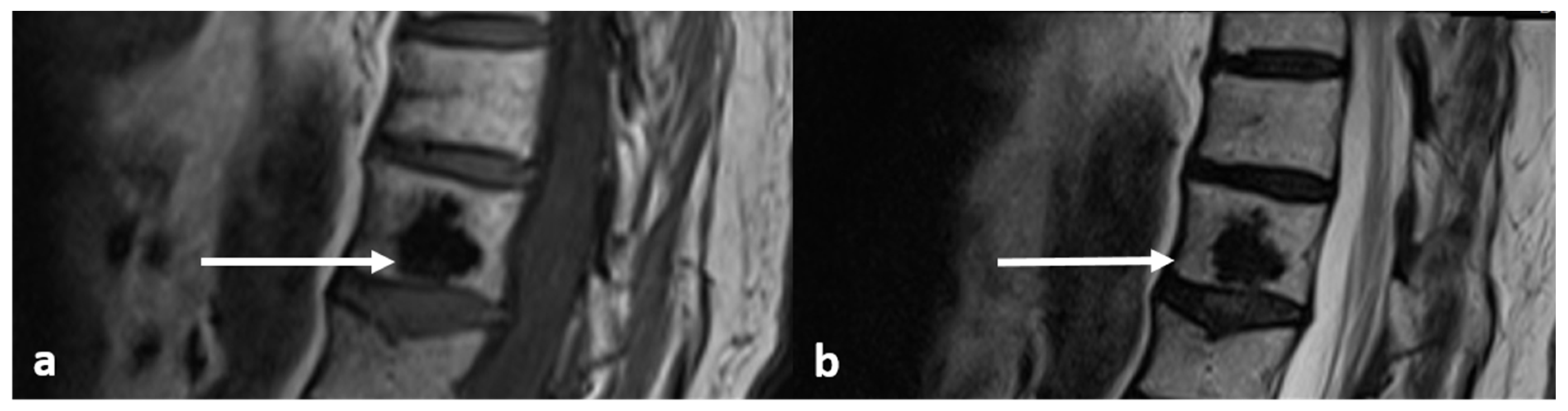 Diagnostics 13 02006 g002