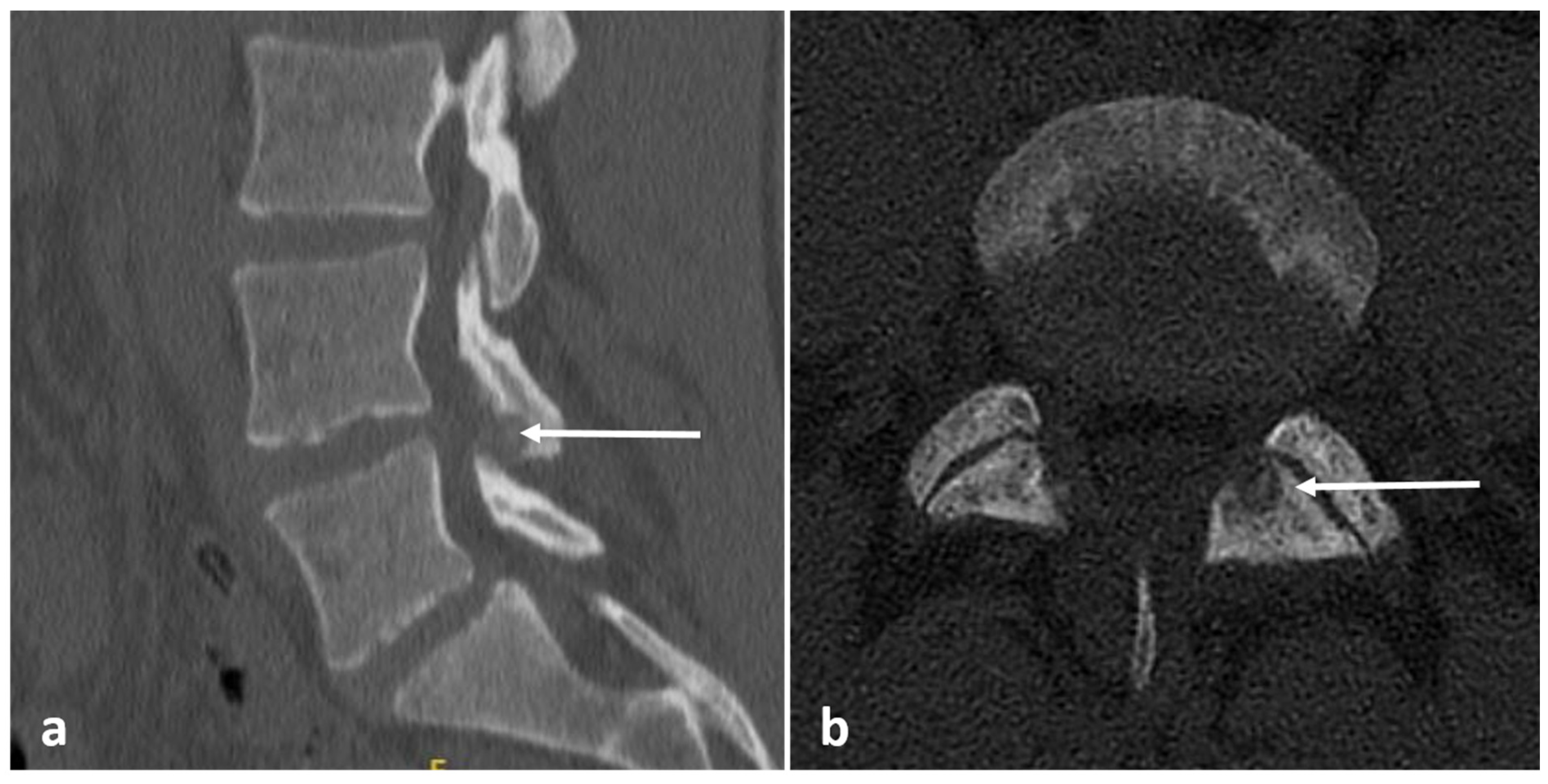 Diagnostics 13 02006 g003