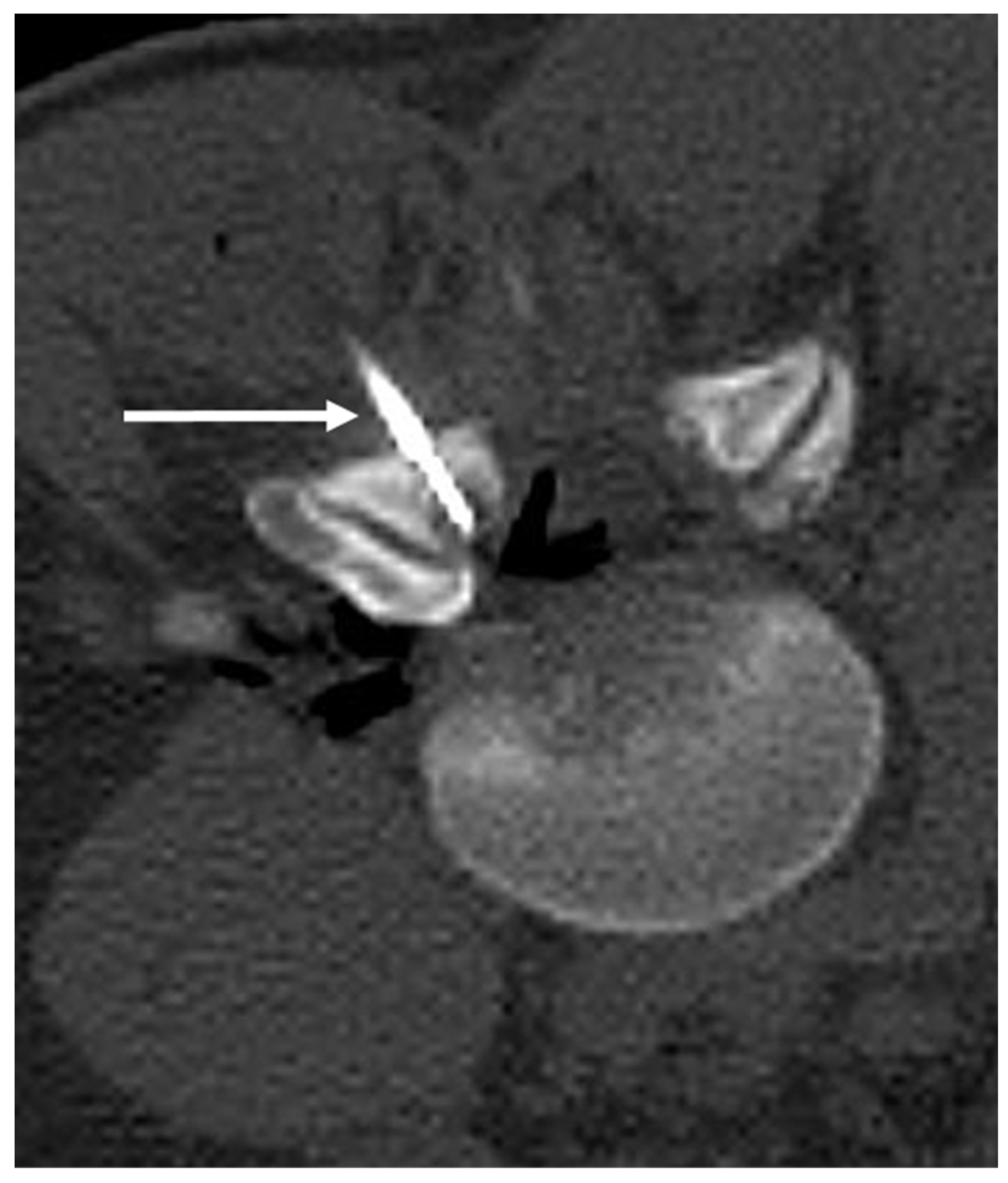 Diagnostics 13 02006 g005