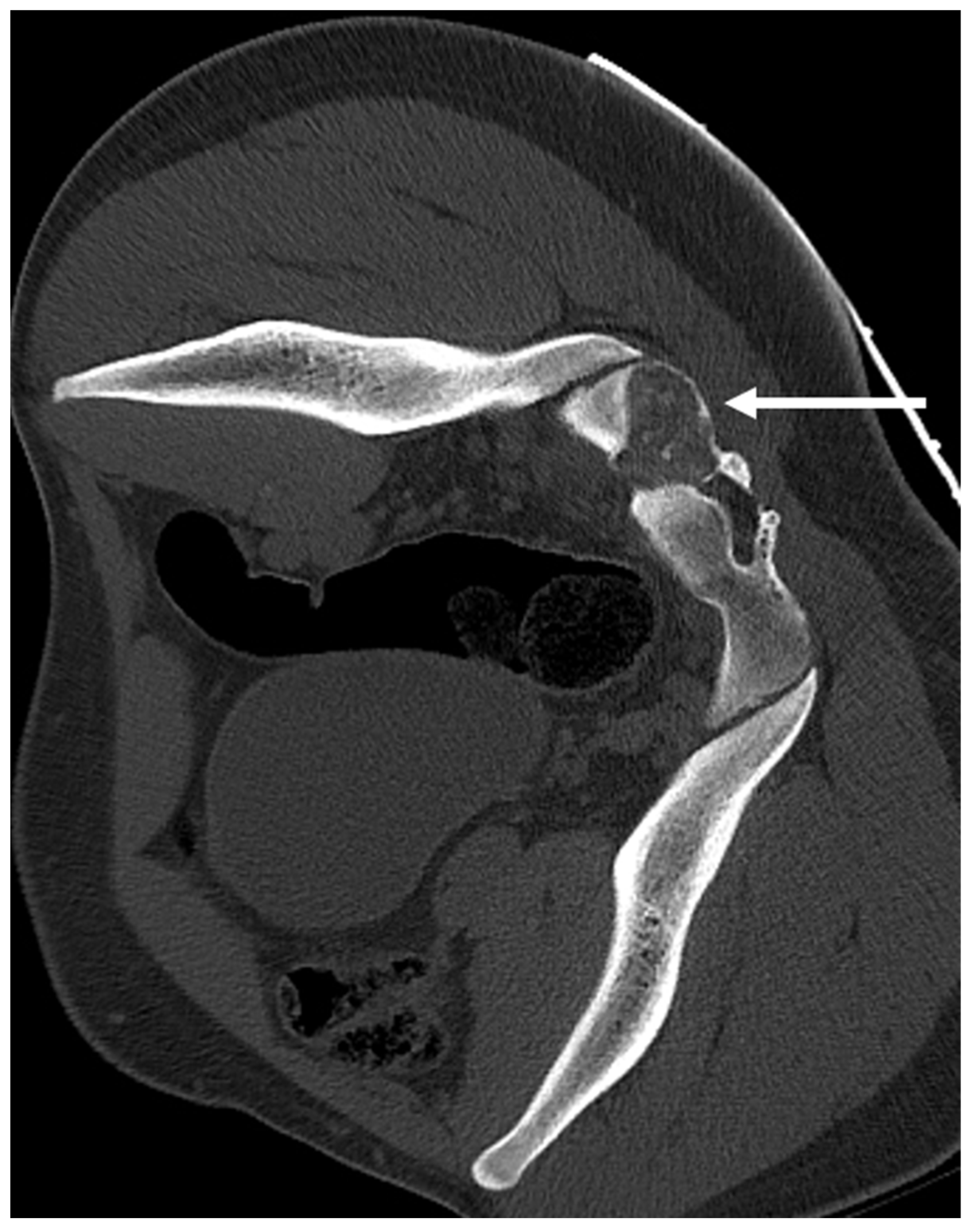 Diagnostics 13 02006 g006