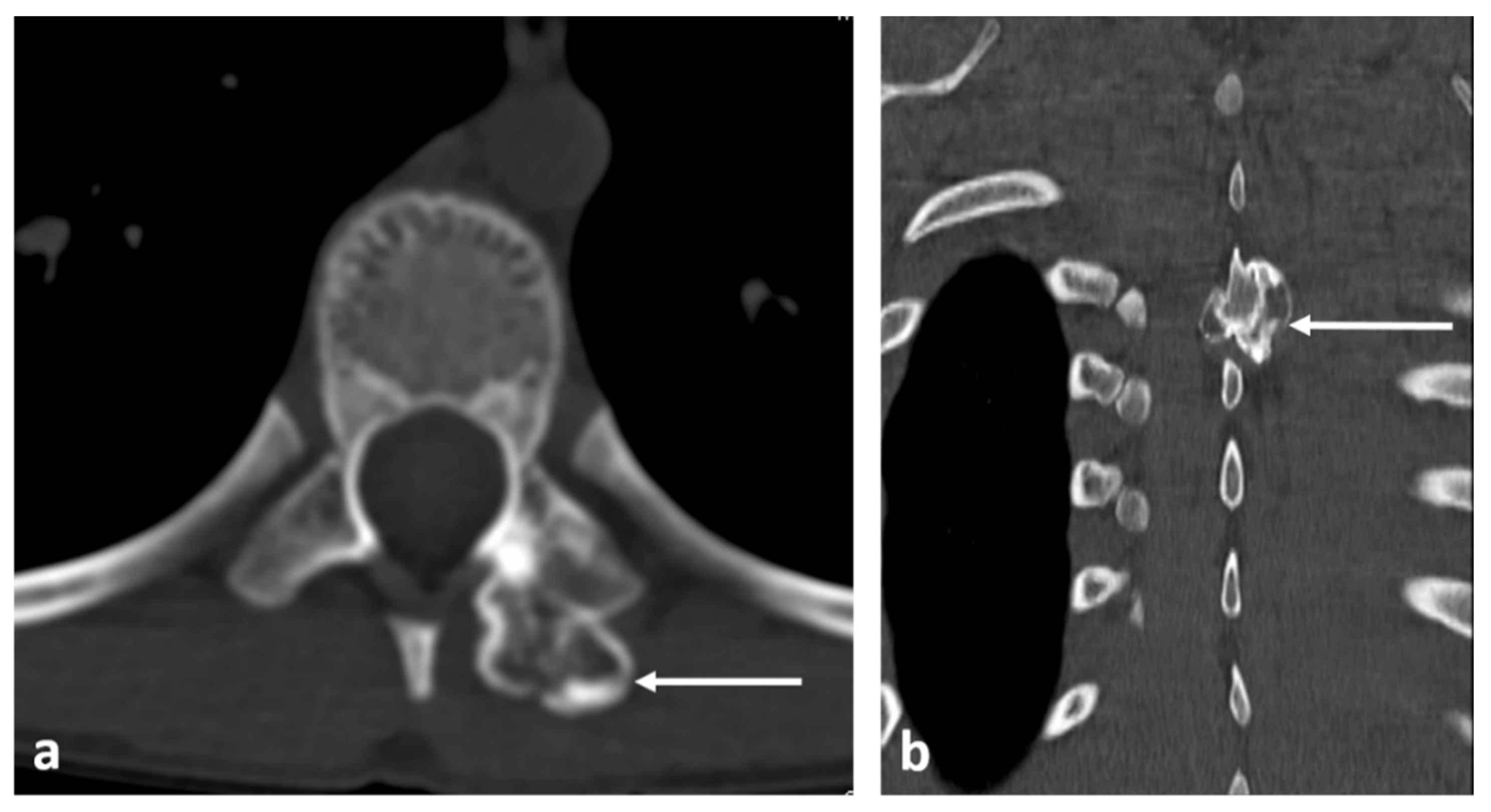 Diagnostics 13 02006 g011