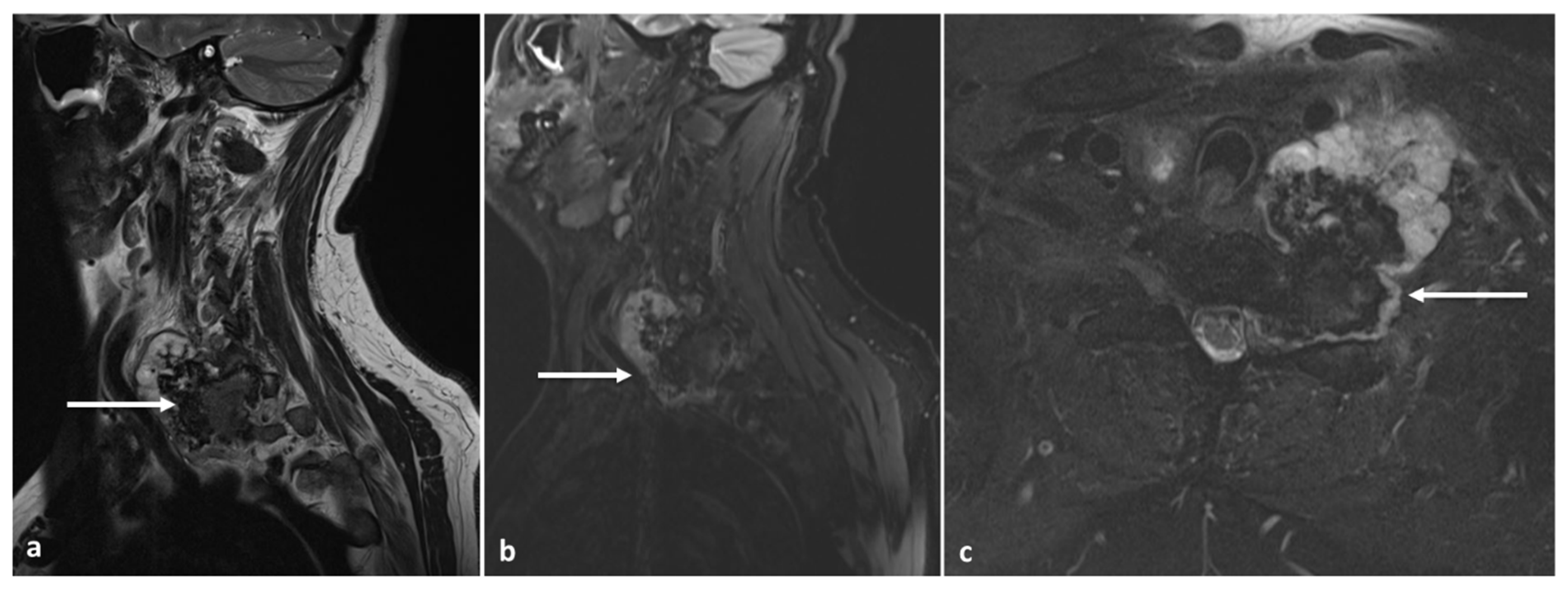 Diagnostics 13 02006 g012