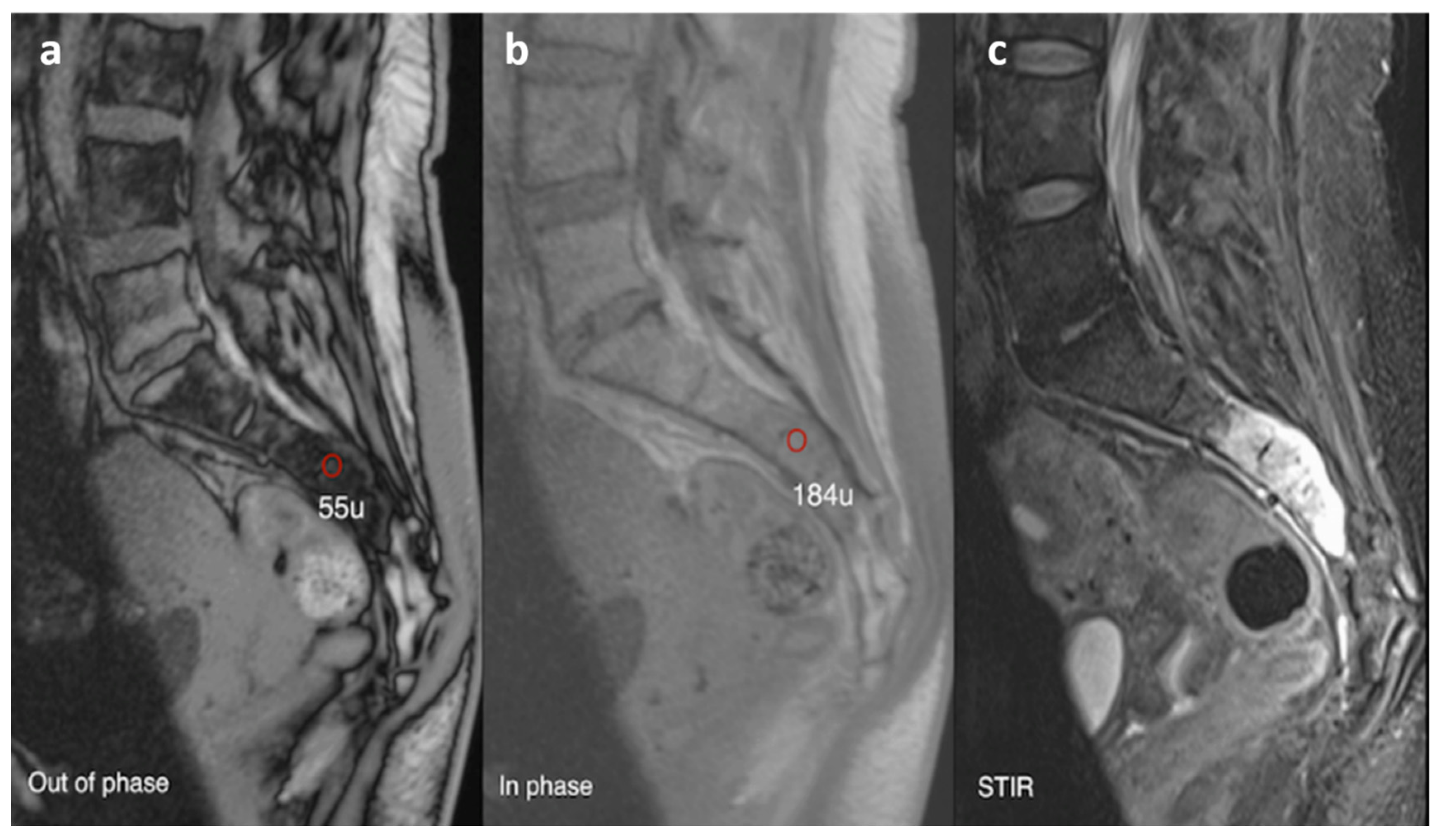 Diagnostics 13 02006 g015