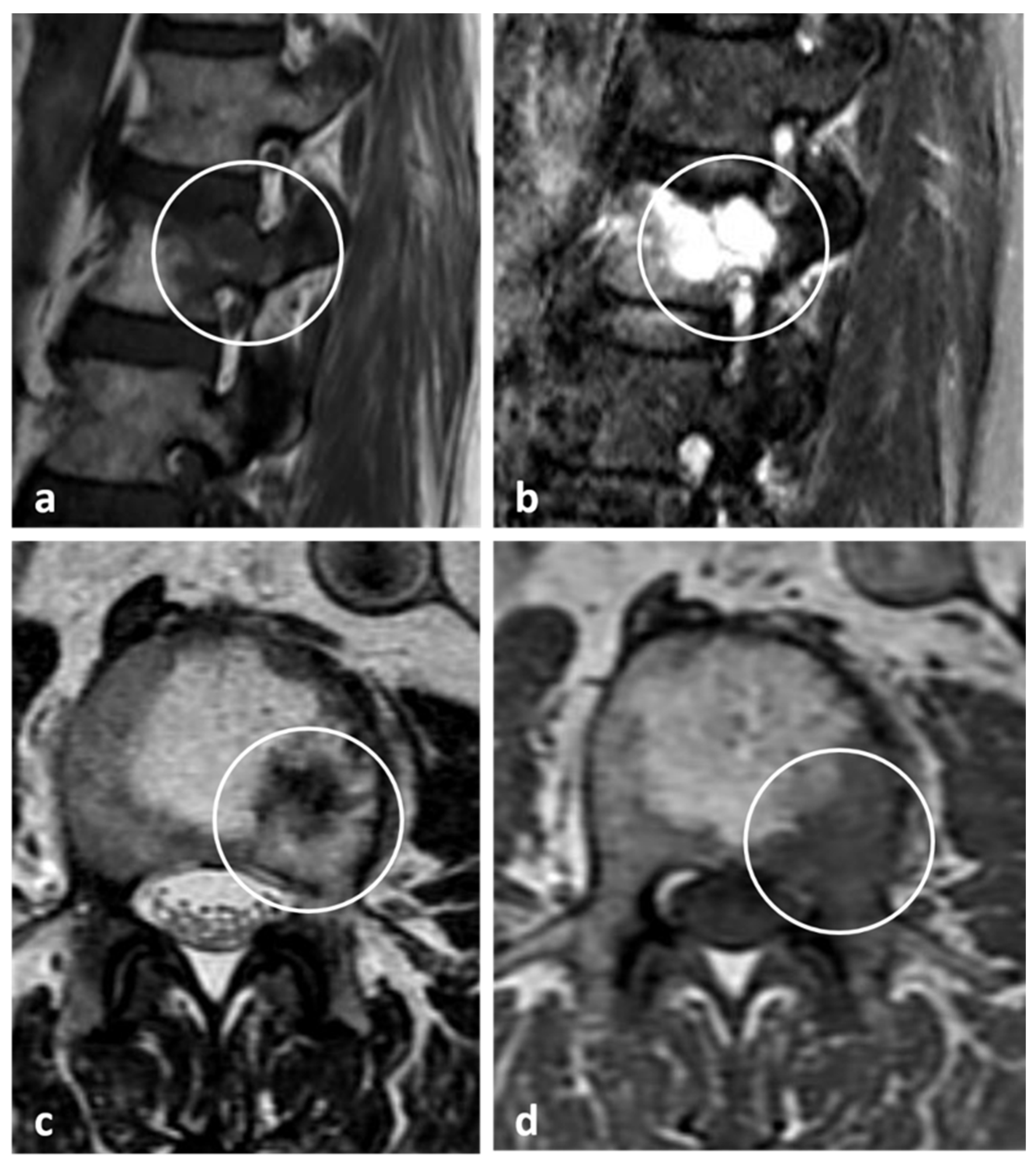Diagnostics 13 02006 g018