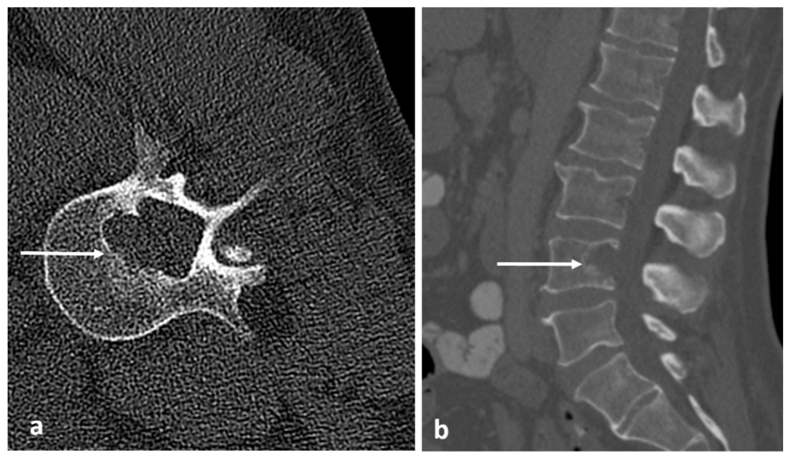 Diagnostics 13 02006 g021
