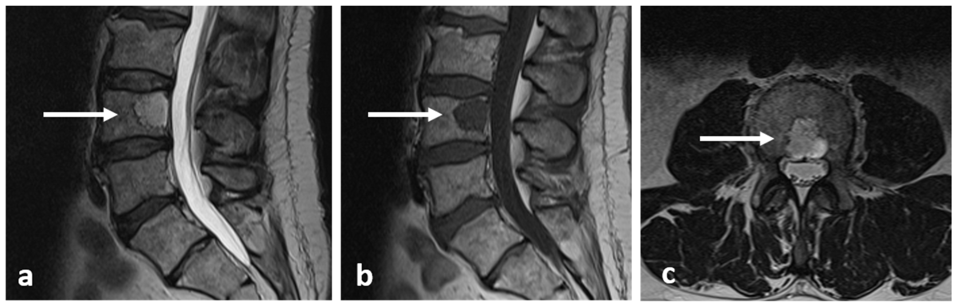 Diagnostics 13 02006 g022