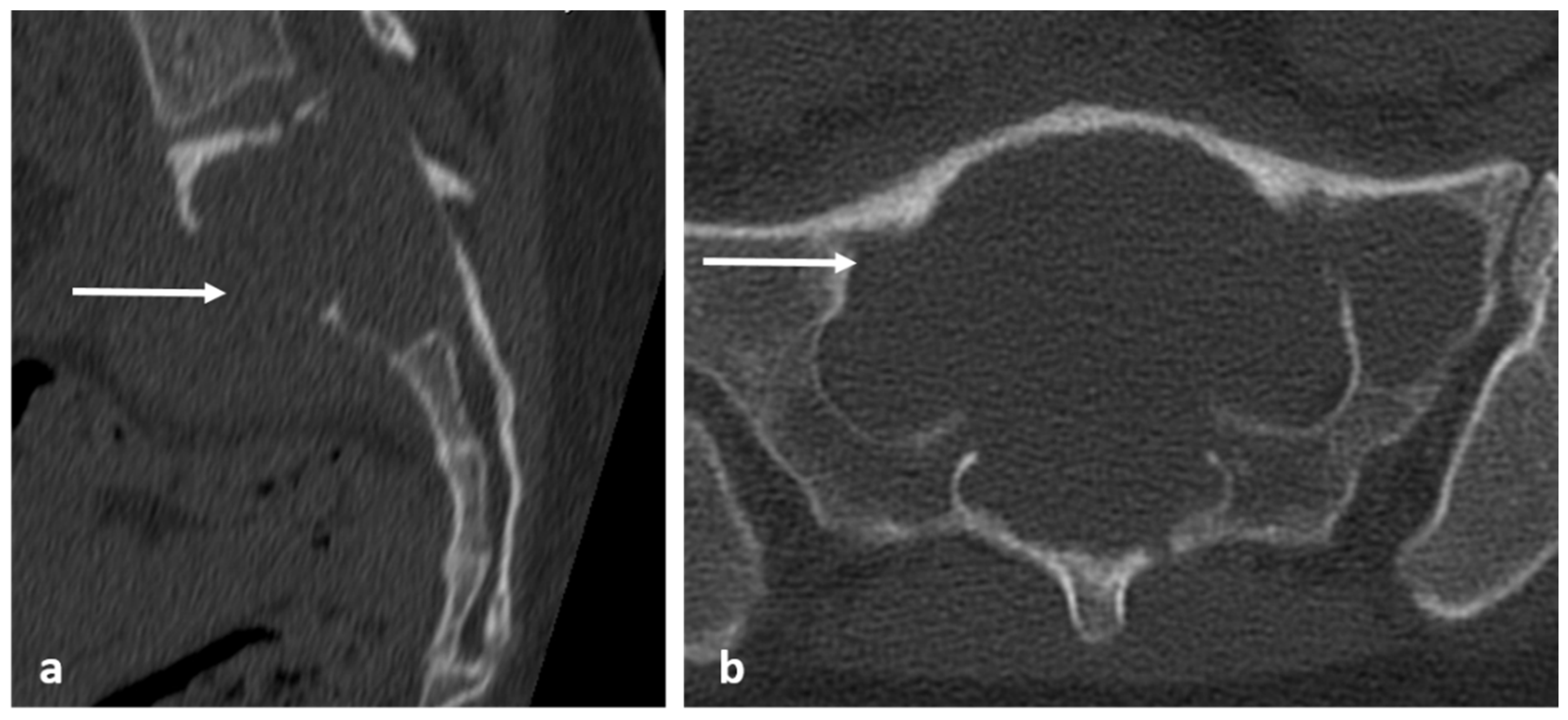 Diagnostics 13 02006 g023