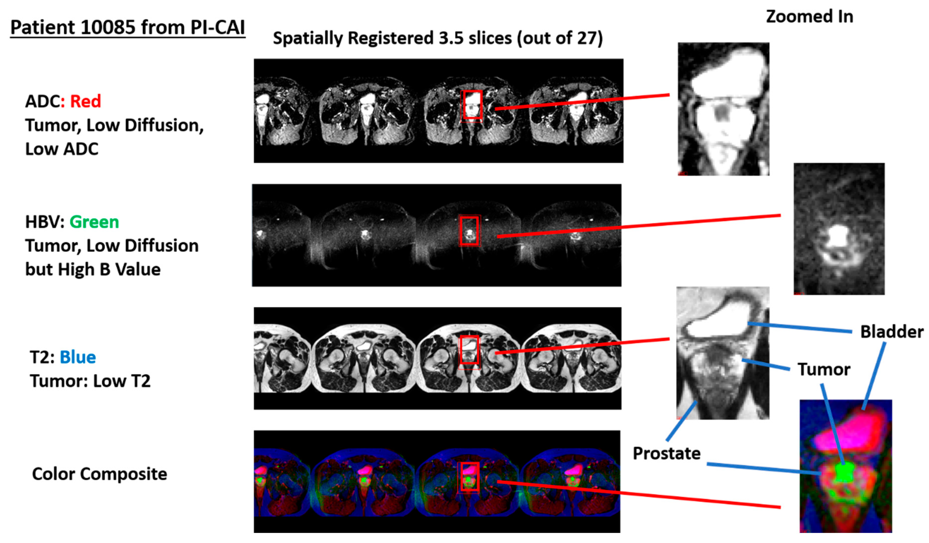Diagnostics 13 02008 g002