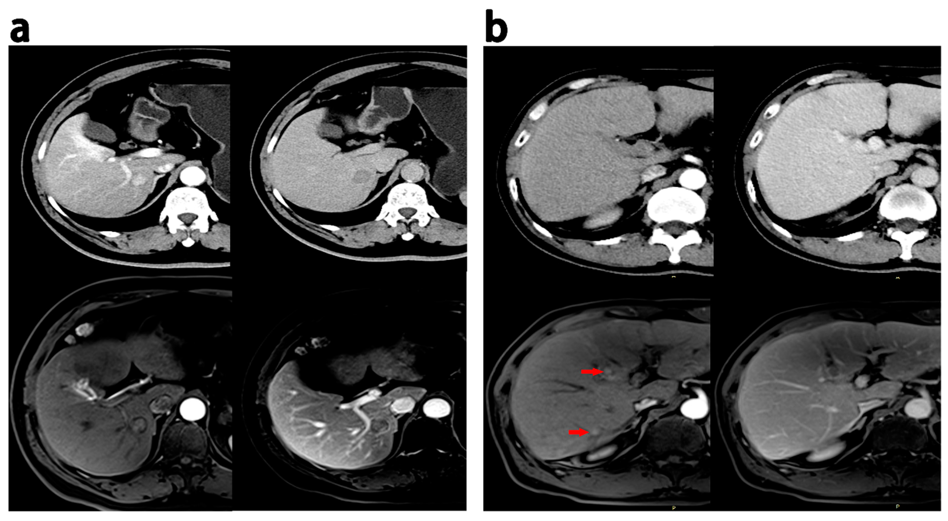 Diagnostics 13 02012 g003 Diagnostics 13 02012 g003