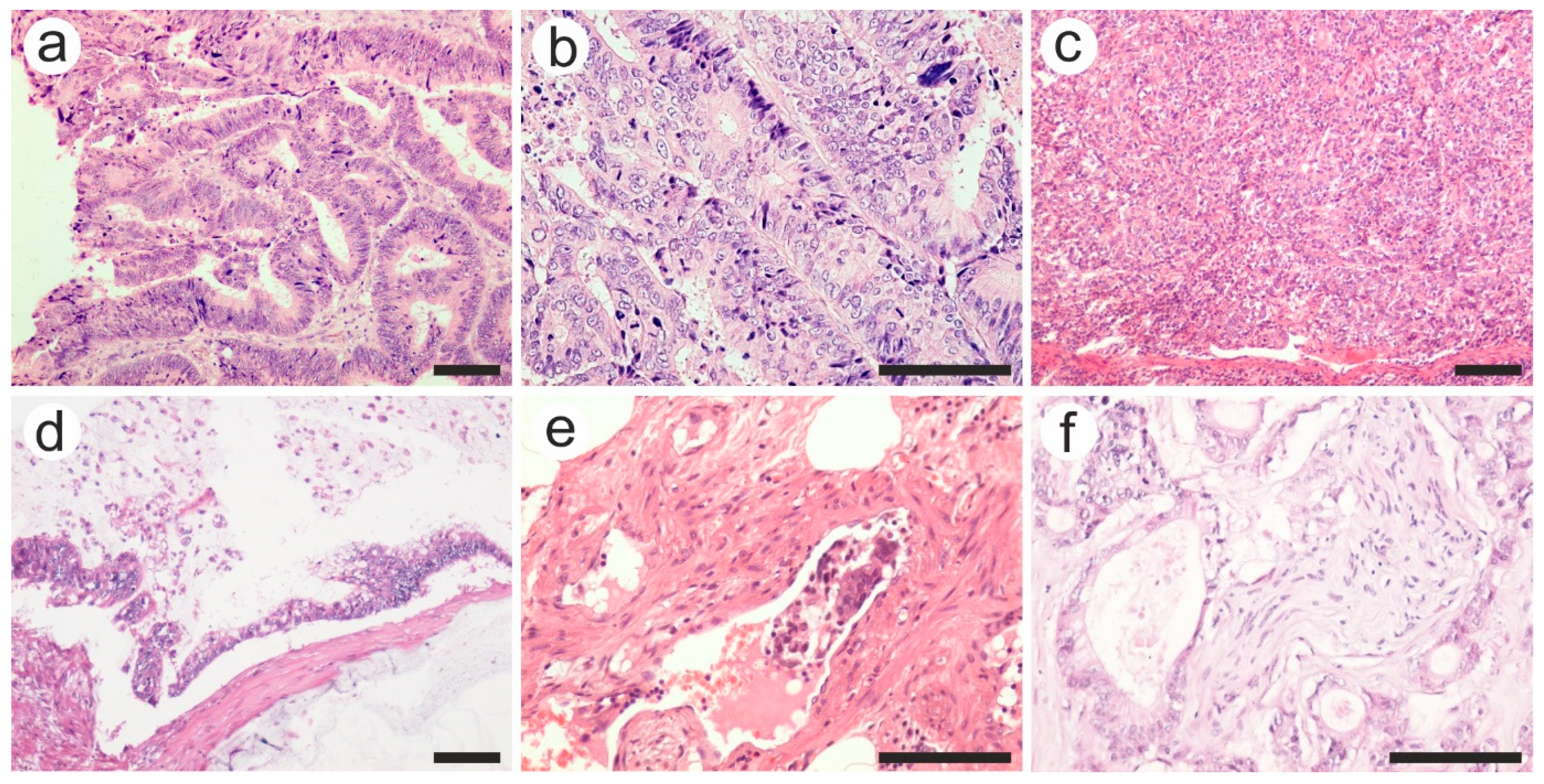 Diagnostics 13 02016 g003