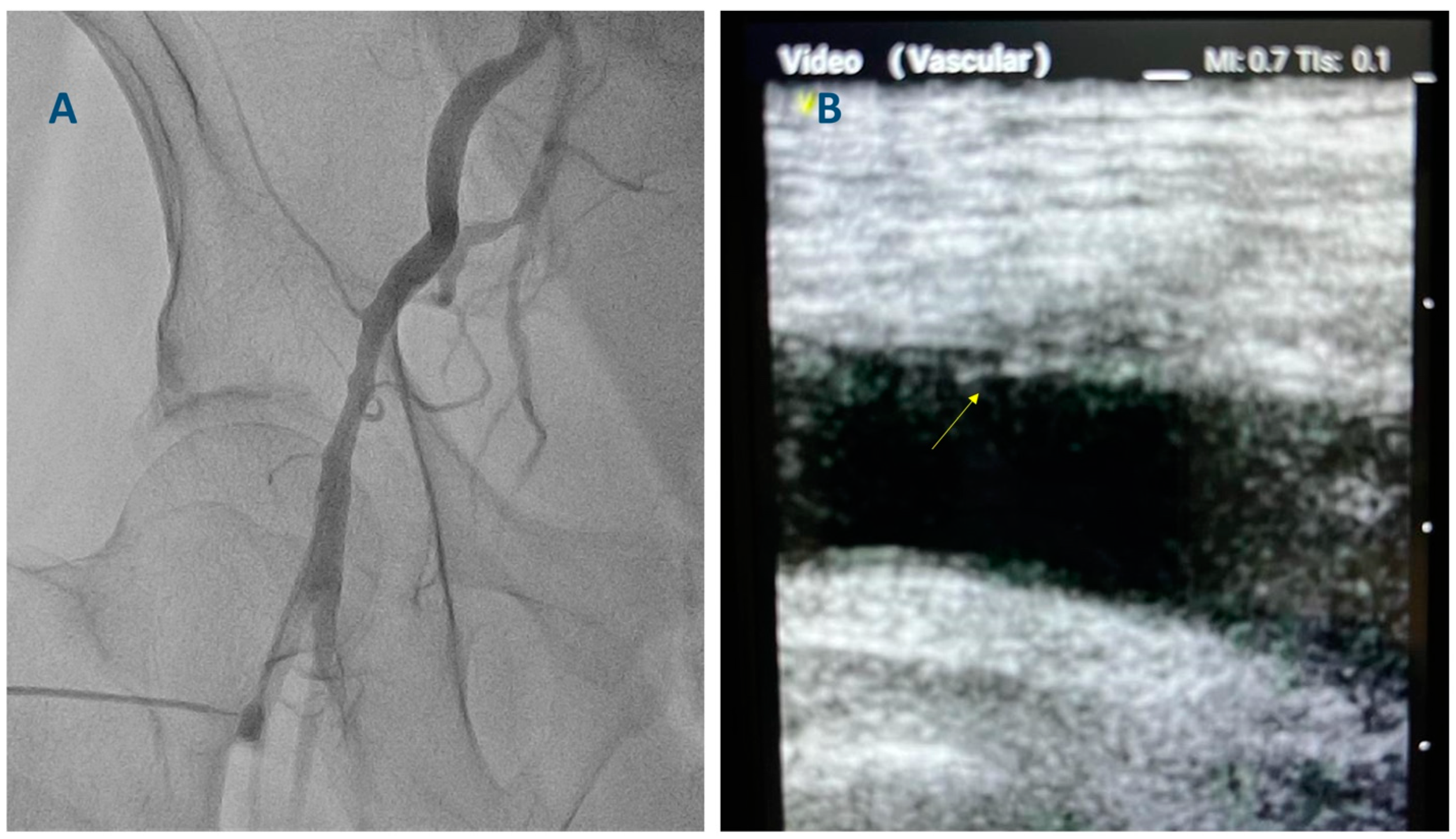 Diagnostics 13 02028 g004