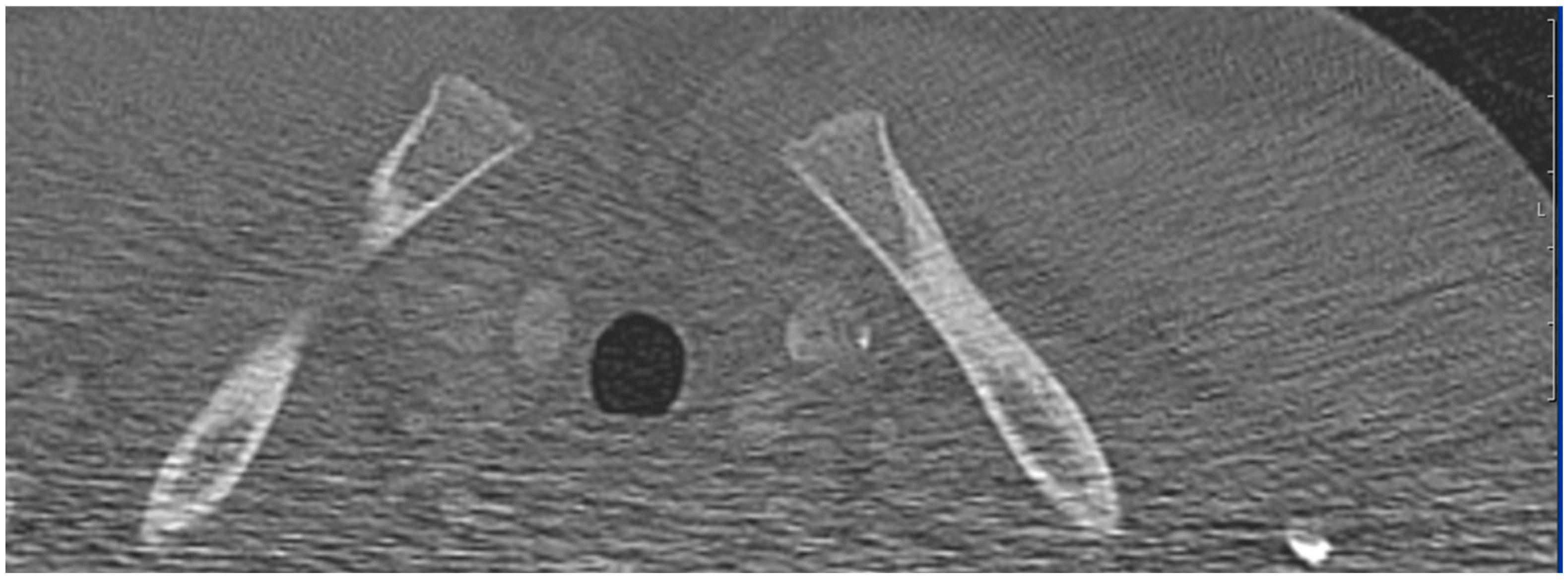 Diagnostics 13 02029 g002