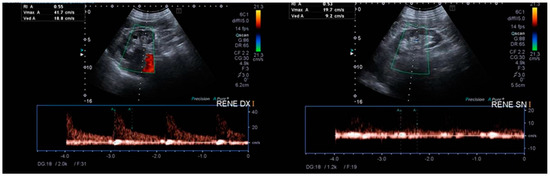 Diagnostics 13 02054 g001