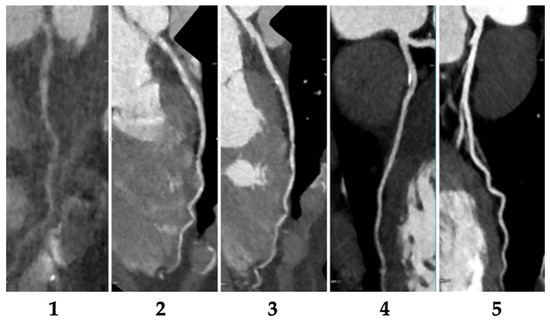 Diagnostics 13 02062 g0a1
