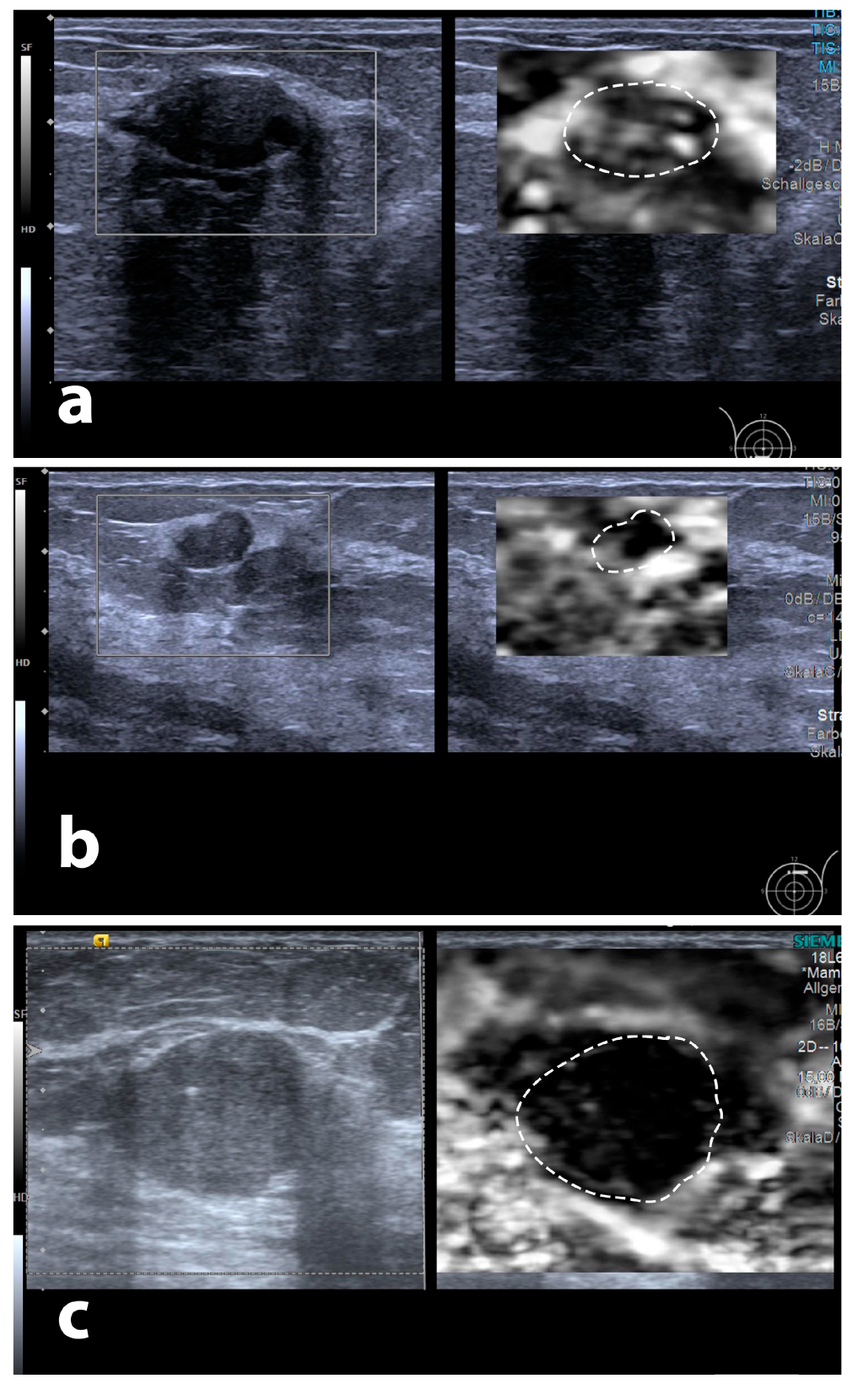 Diagnostics 13 02064 g007