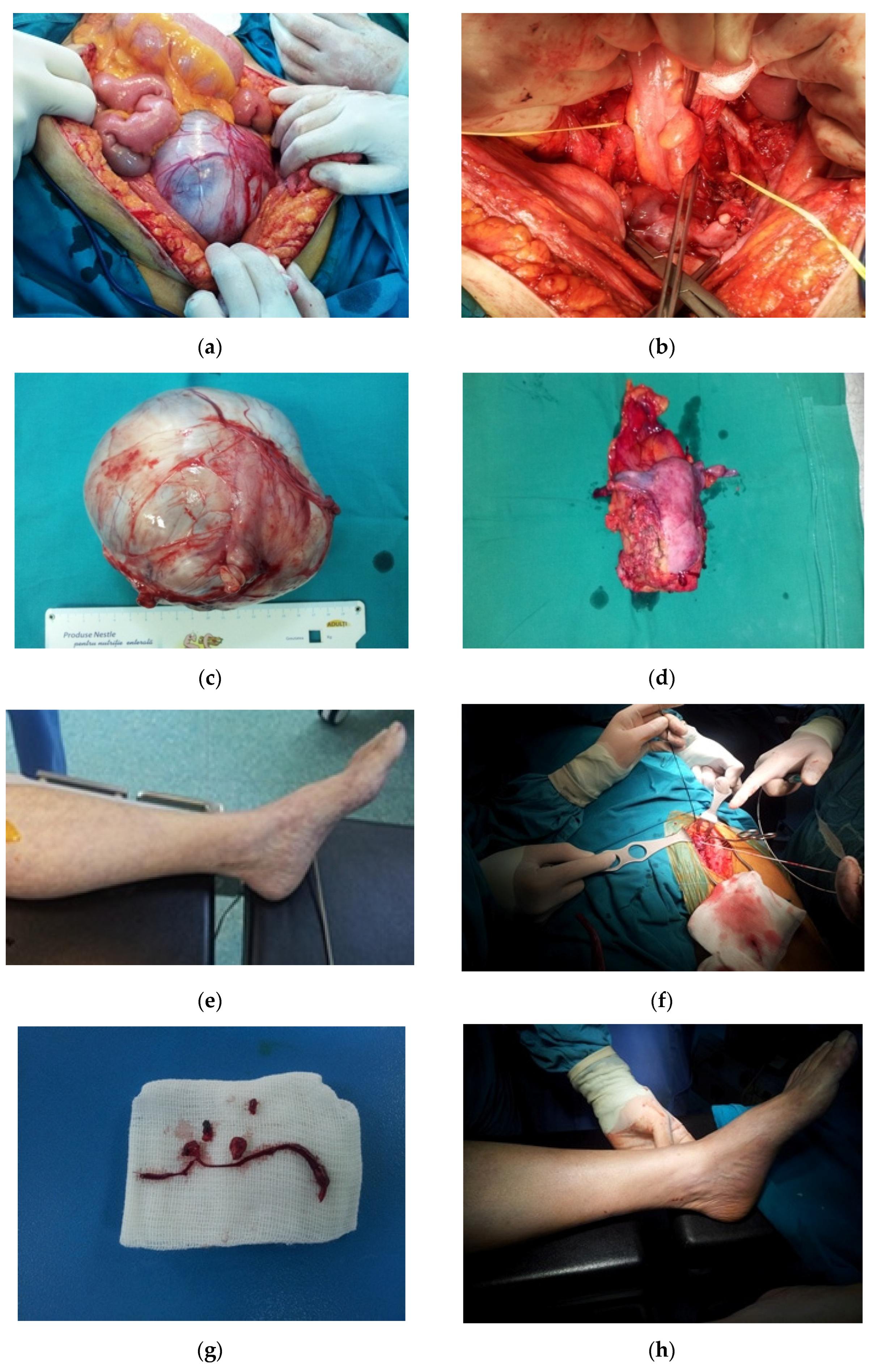 Diagnostics 13 02069 g004