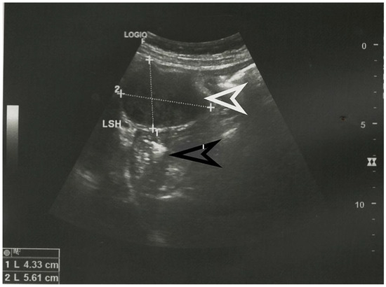 Diagnostics 13 02073 g001