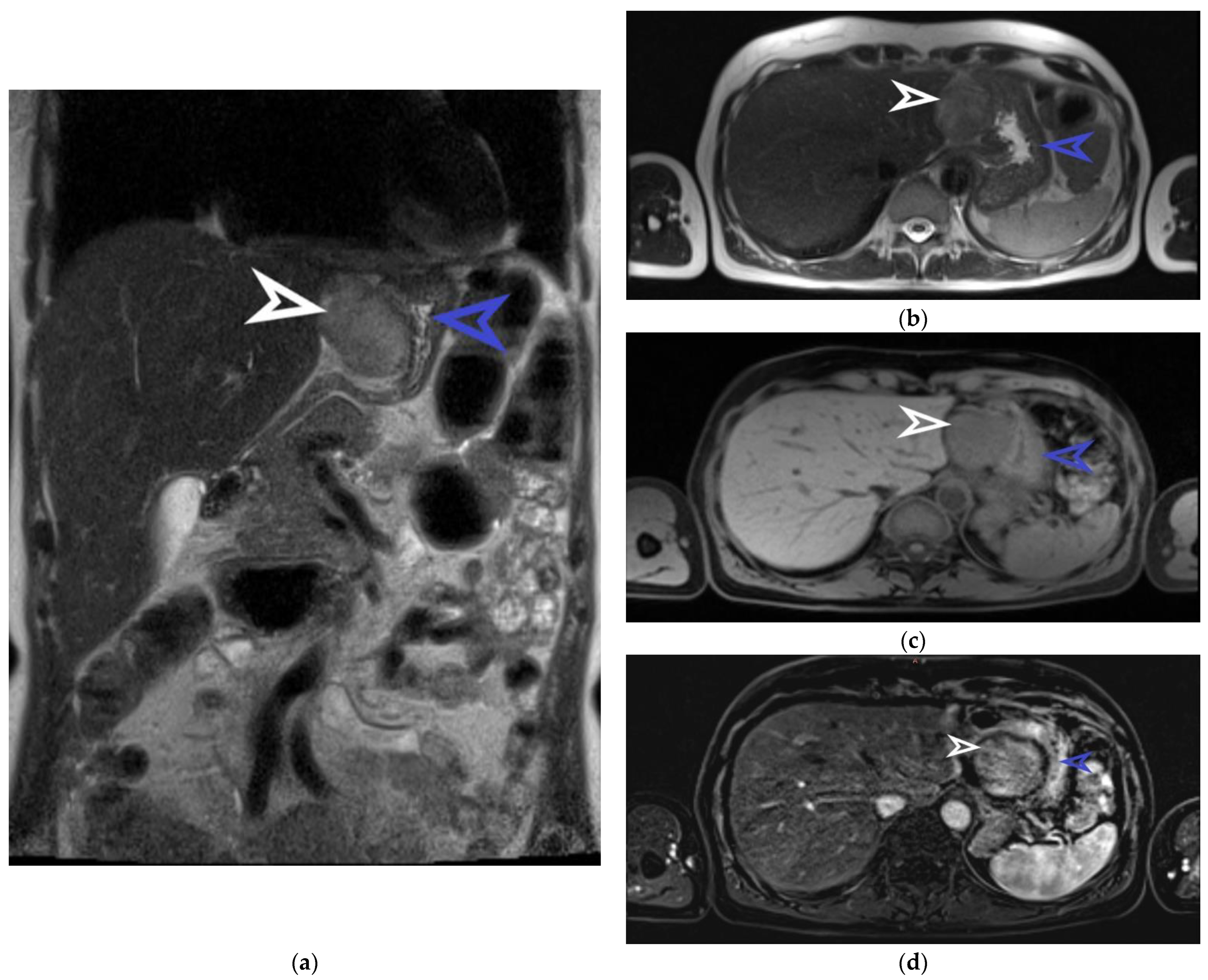 Diagnostics 13 02073 g002