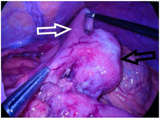 Diagnostics 13 02073 g003