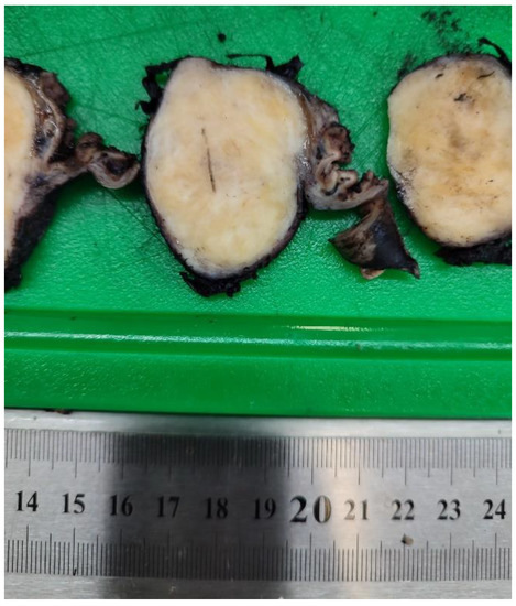 Diagnostics 13 02073 g004