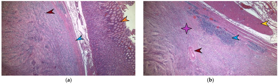 Diagnostics 13 02073 g005