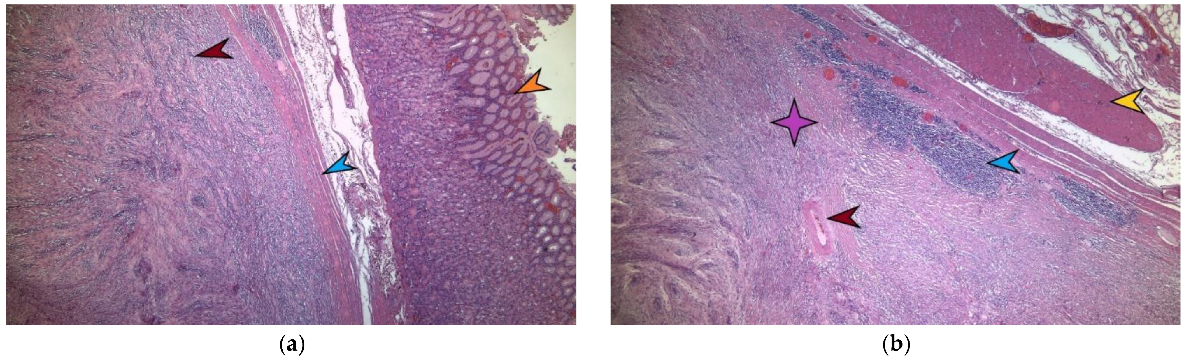 Diagnostics 13 02073 g005