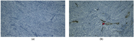 Diagnostics 13 02073 g006