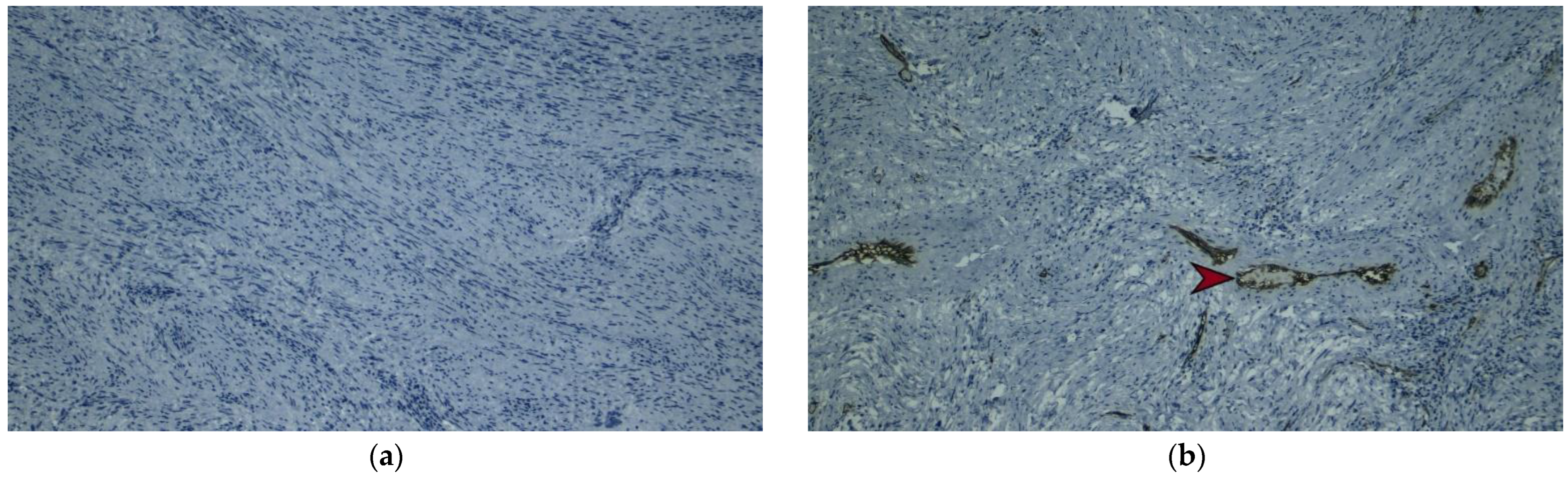 Diagnostics 13 02073 g006