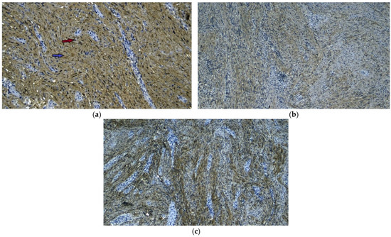 Diagnostics 13 02073 g008