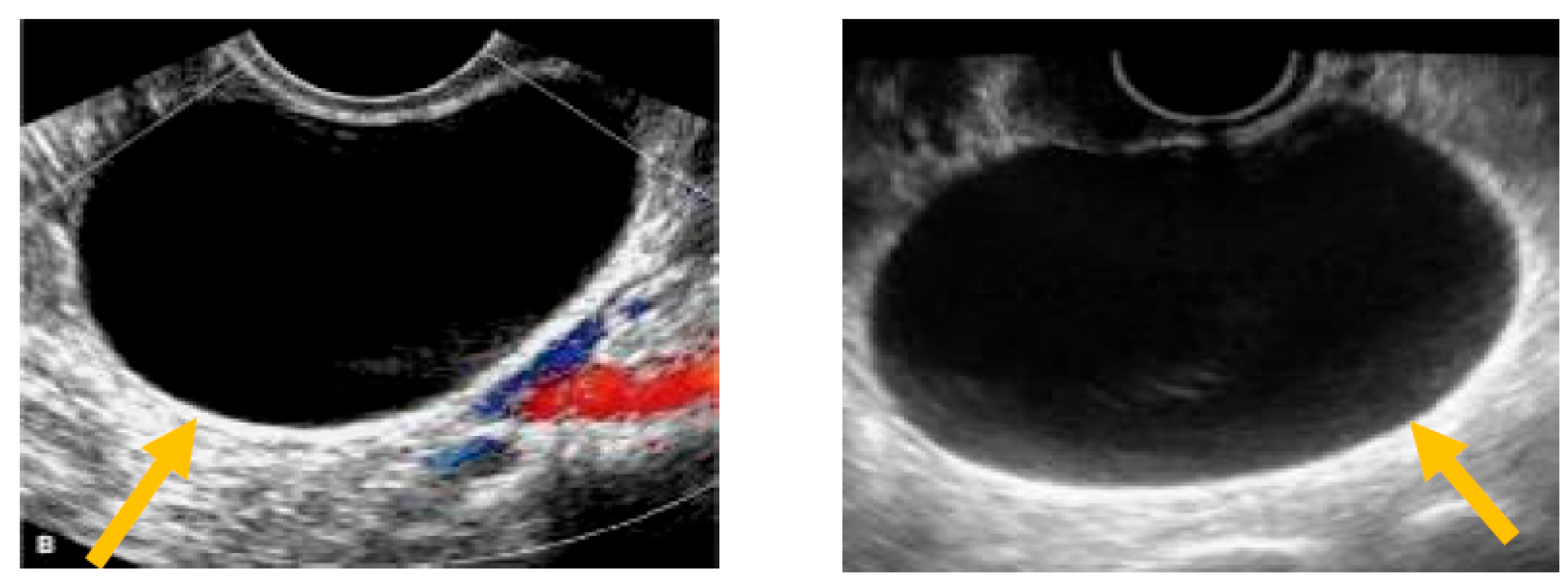 Diagnostics 13 02078 g001 Diagnostics 13 02078 g001