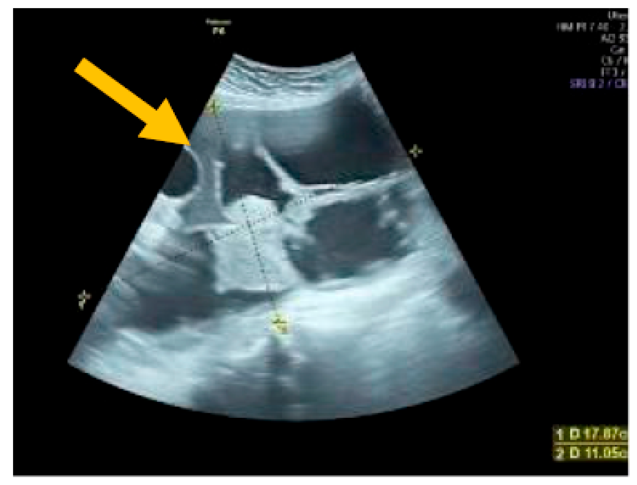 Diagnostics 13 02078 g002 Diagnostics 13 02078 g002