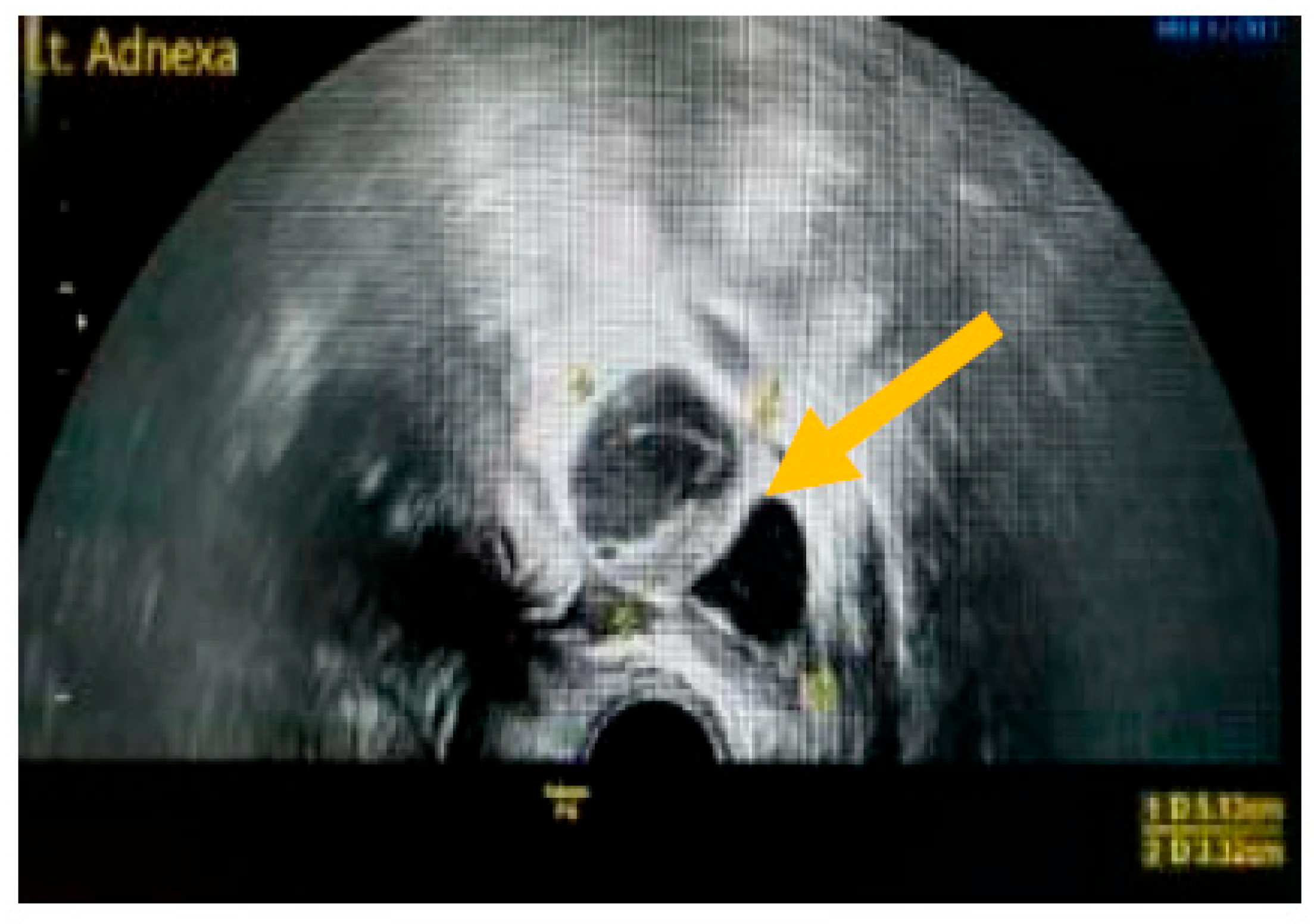 Diagnostics 13 02078 g003 Diagnostics 13 02078 g003