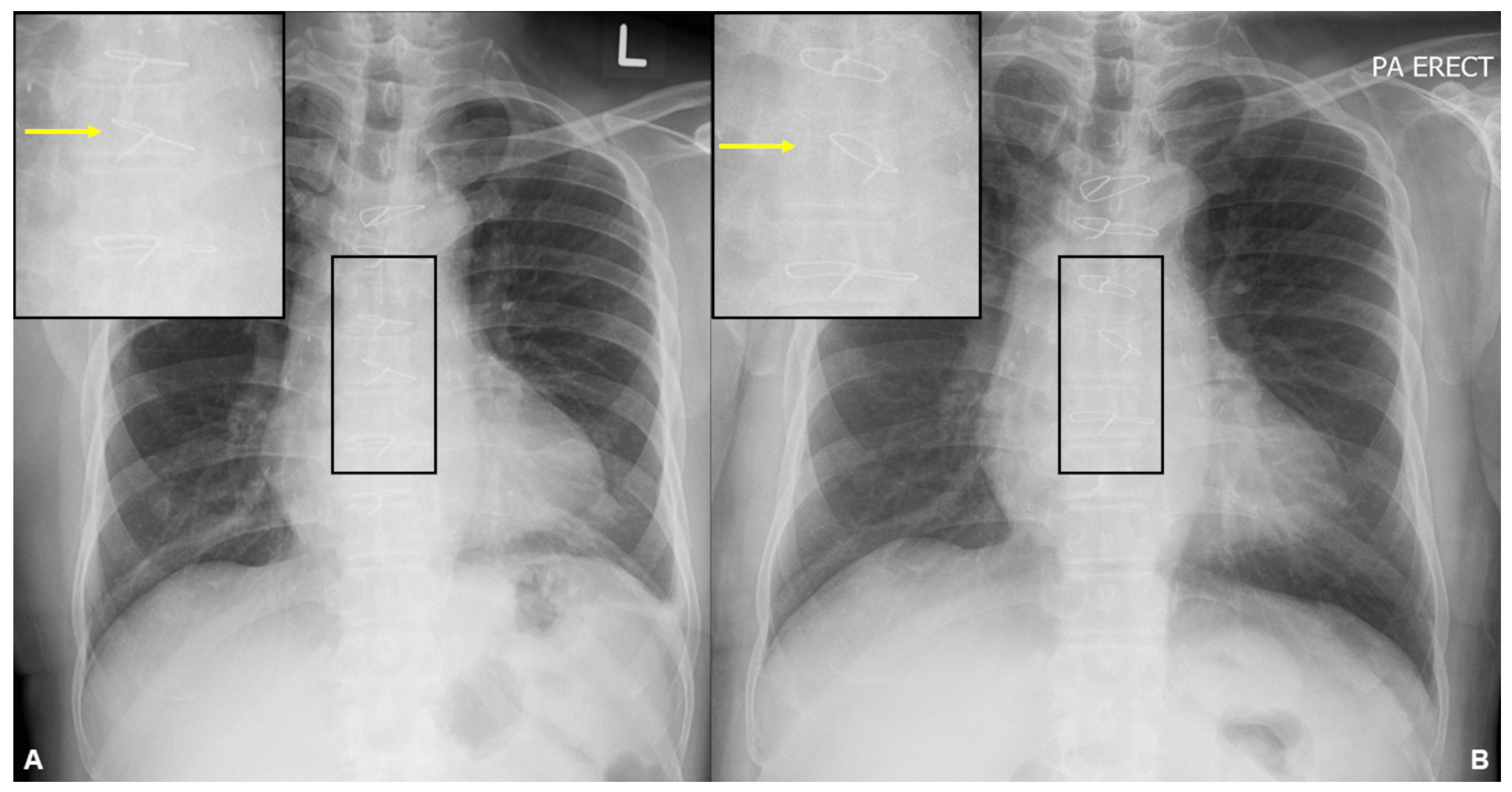 Diagnostics 13 02082 g001