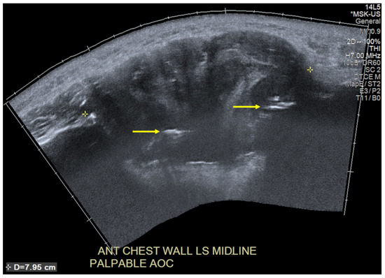 Diagnostics 13 02082 g002