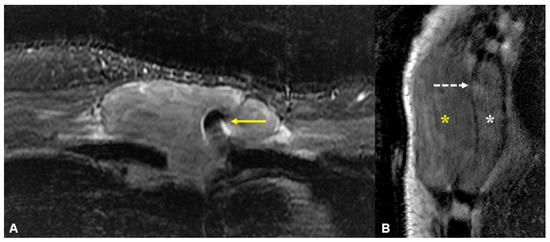 Diagnostics 13 02082 g003