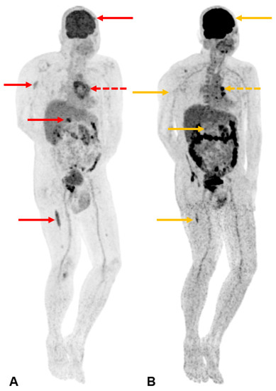 Diagnostics 13 02082 g004