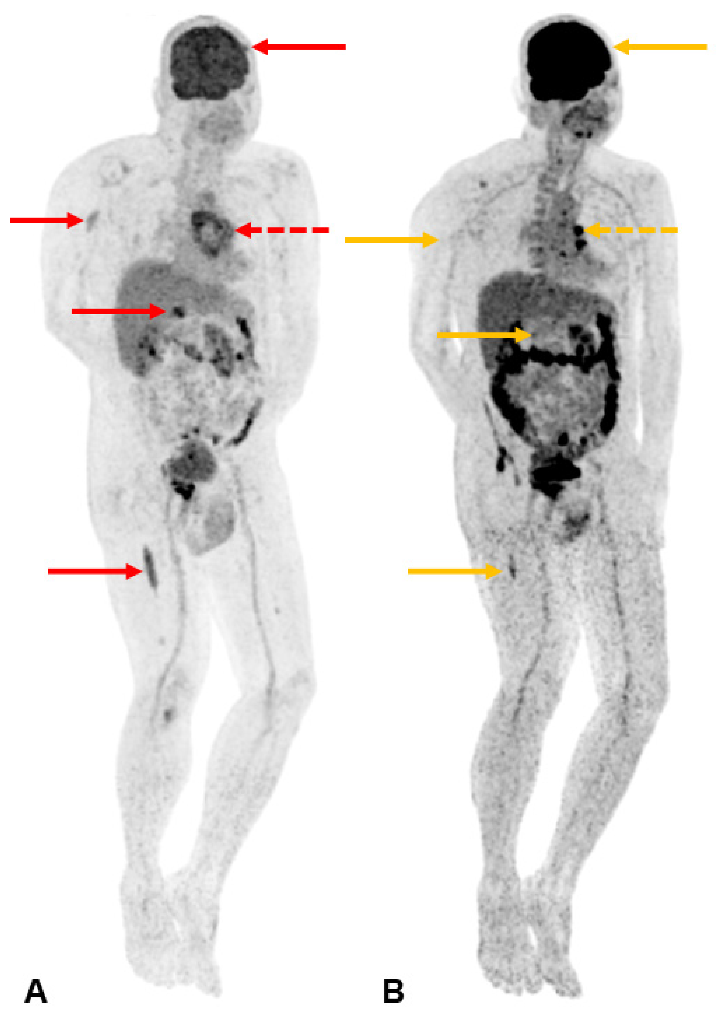 Diagnostics 13 02082 g004