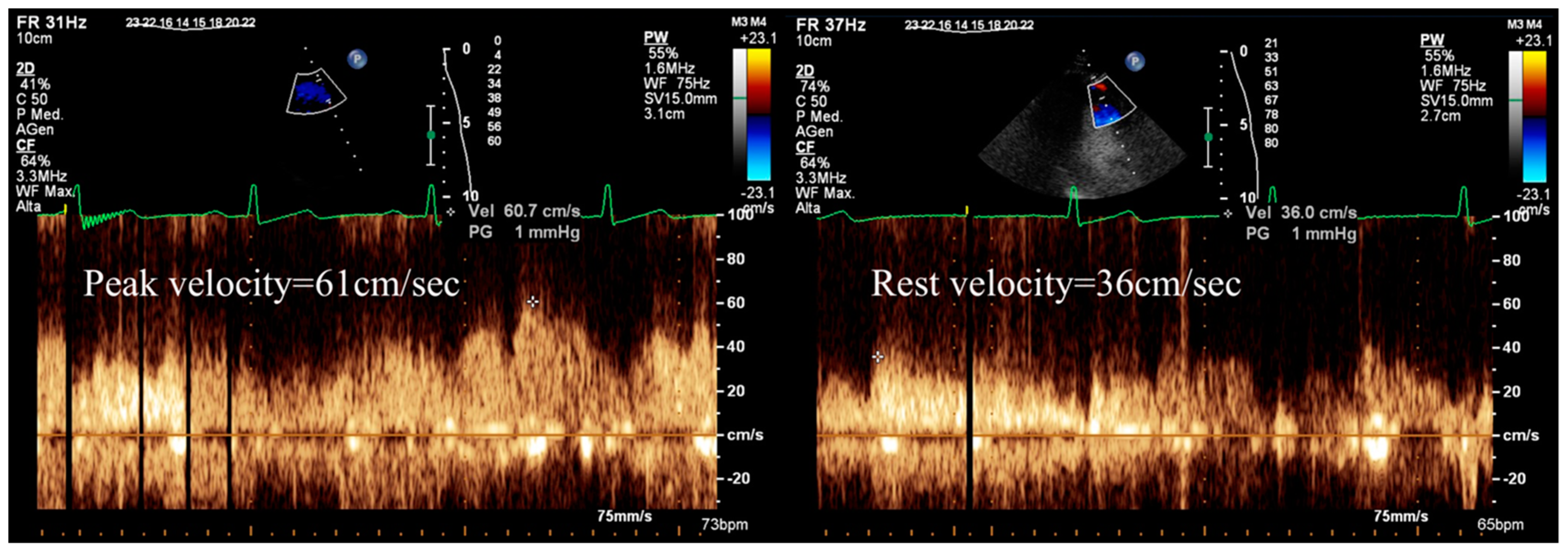 Diagnostics 13 02083 g002
