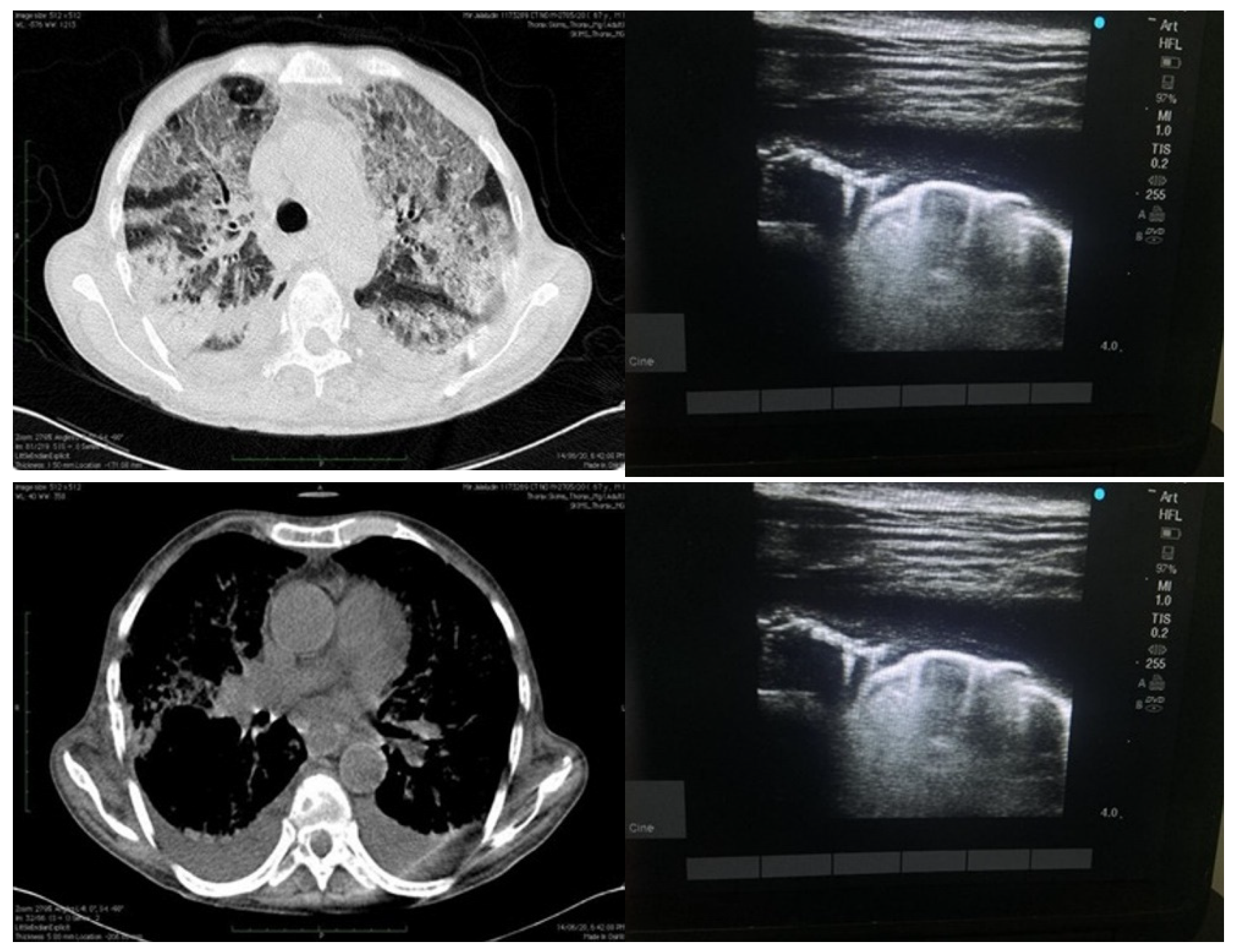 Diagnostics 13 02091 g003 Diagnostics 13 02091 g003