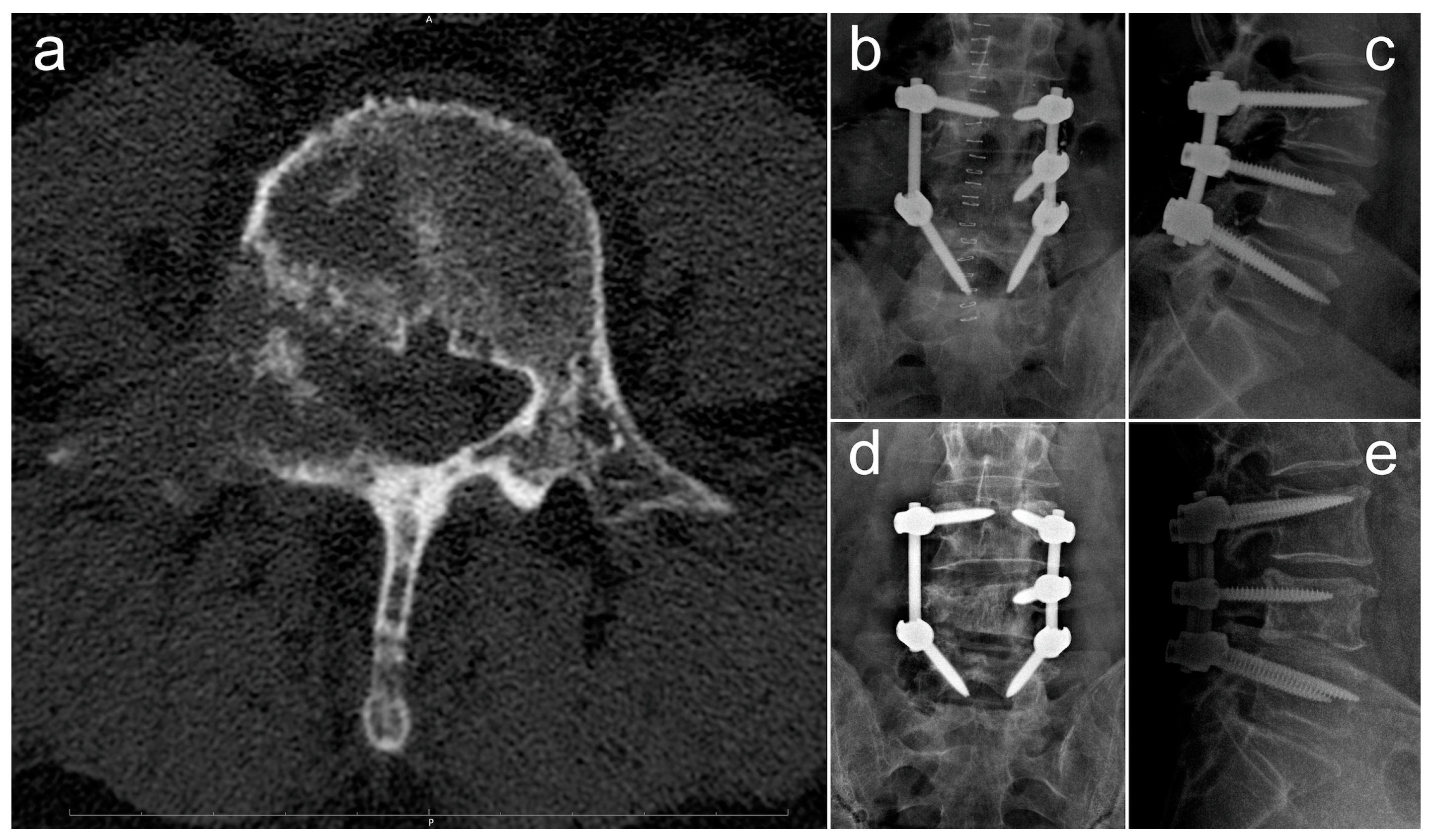 Diagnostics 13 02093 g004