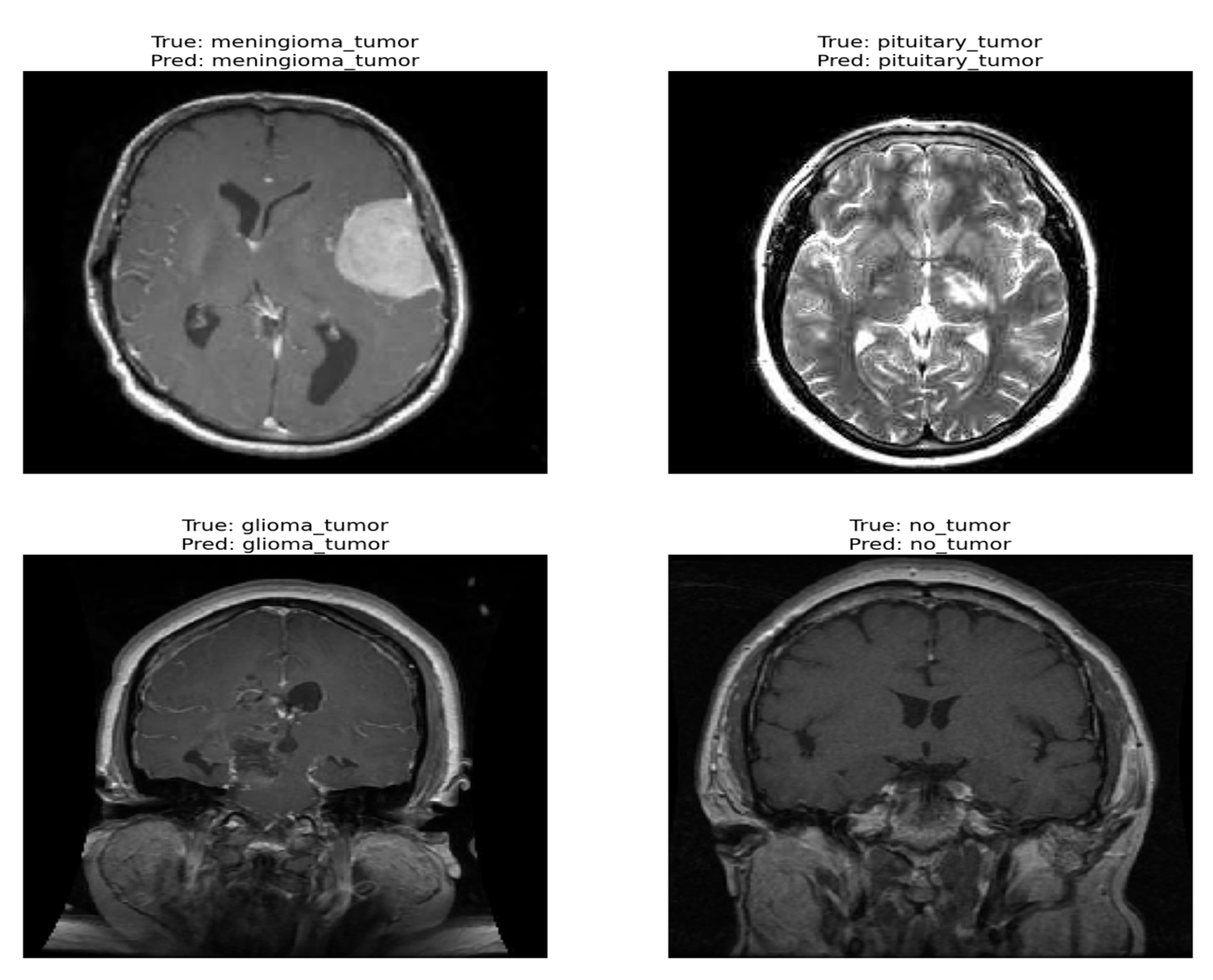 Diagnostics 13 02094 g005 Diagnostics 13 02094 g005