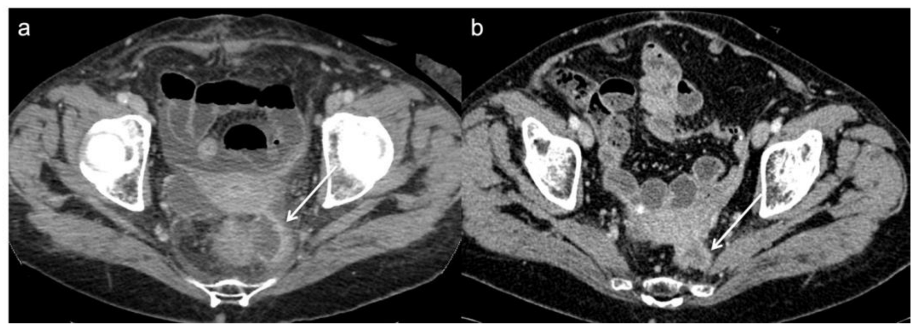 Diagnostics 13 02104 g002