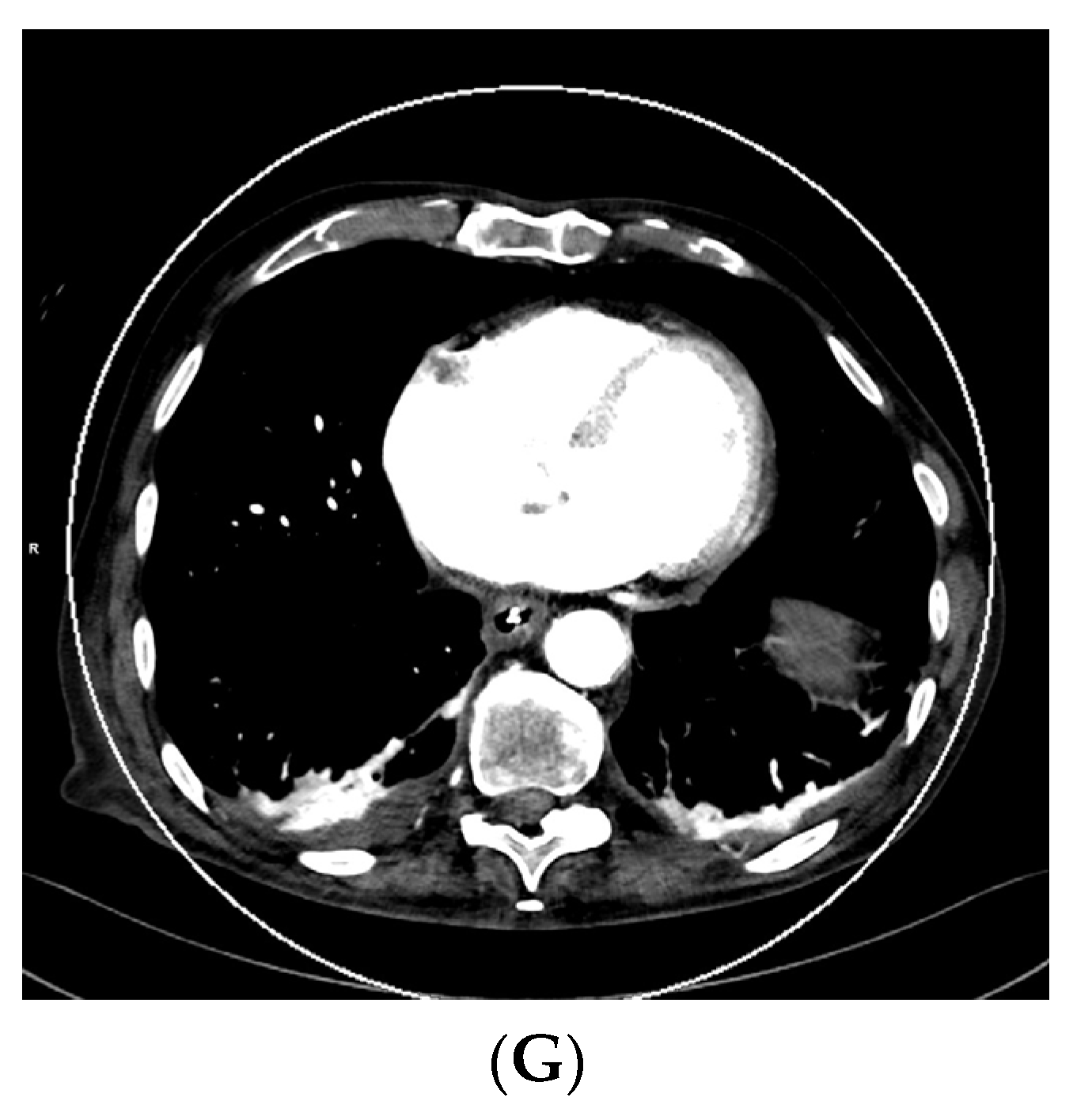 Diagnostics 13 02116 g001b