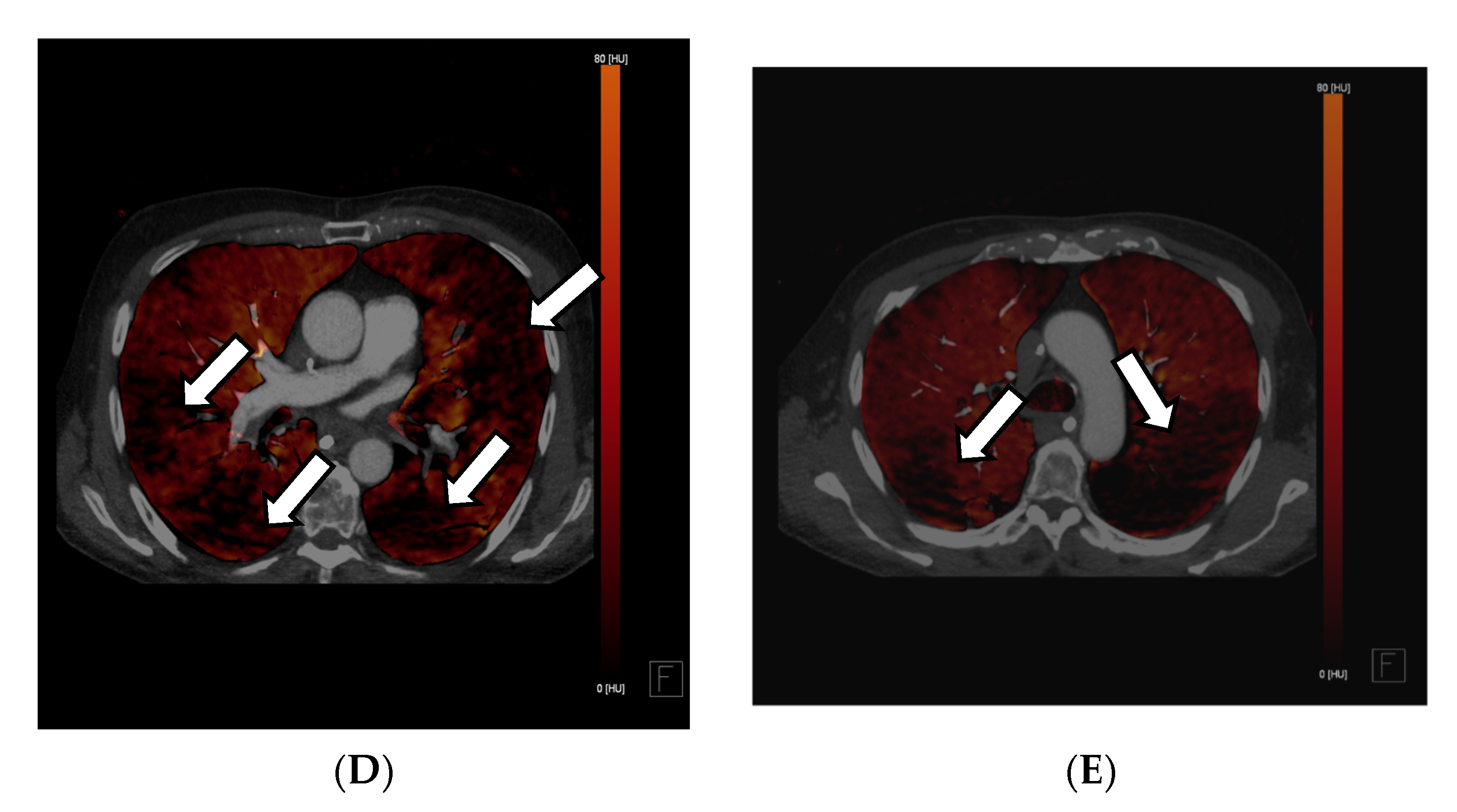 Diagnostics 13 02116 g002b